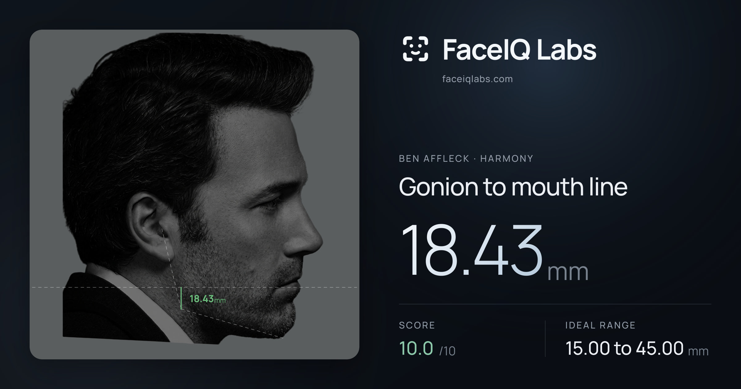 Ben Affleck Gonion to mouth line: 18.43mm, drawn on the photo