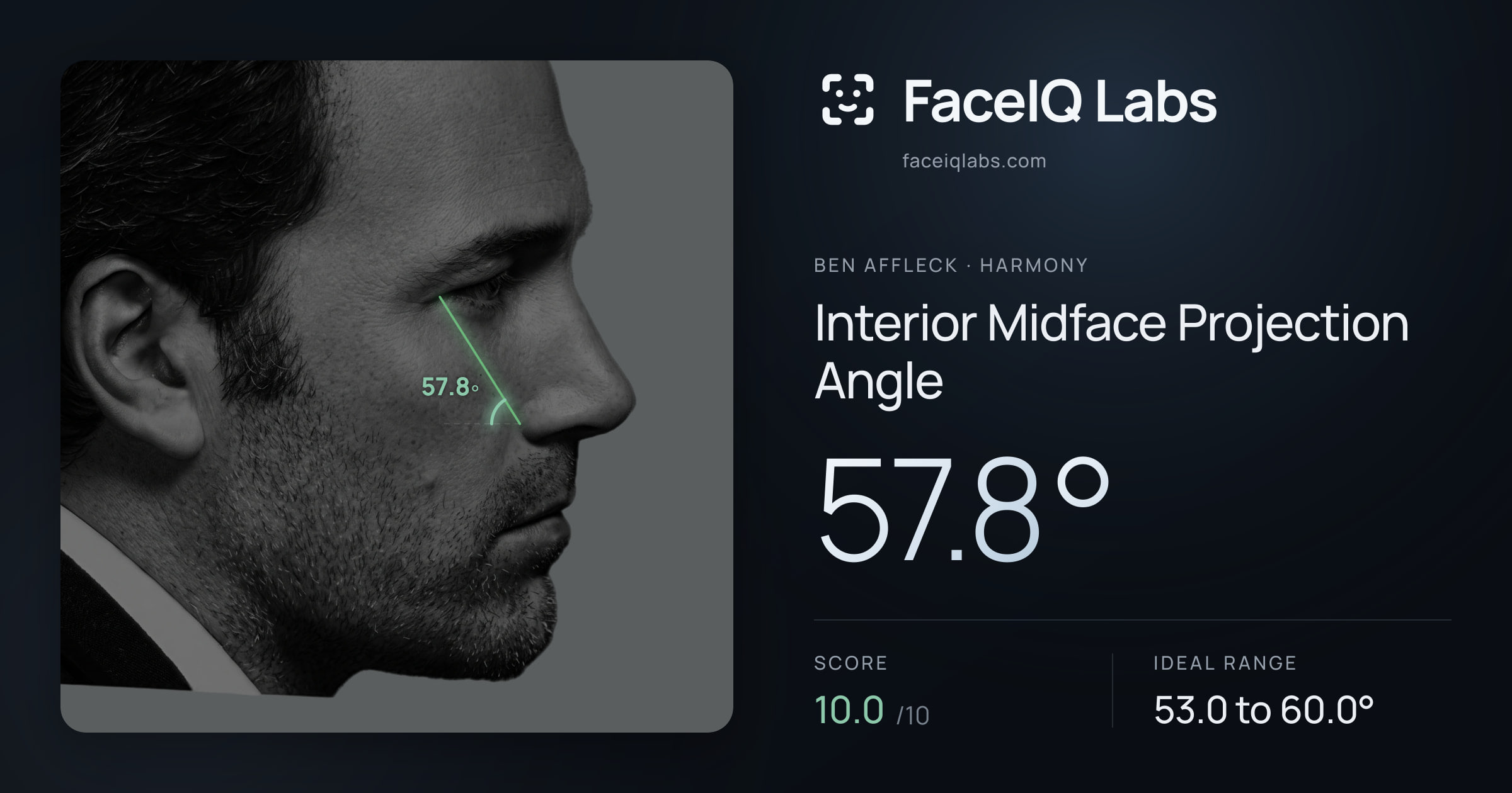 Ben Affleck Interior Midface Projection Angle: 57.8°, drawn on the photo