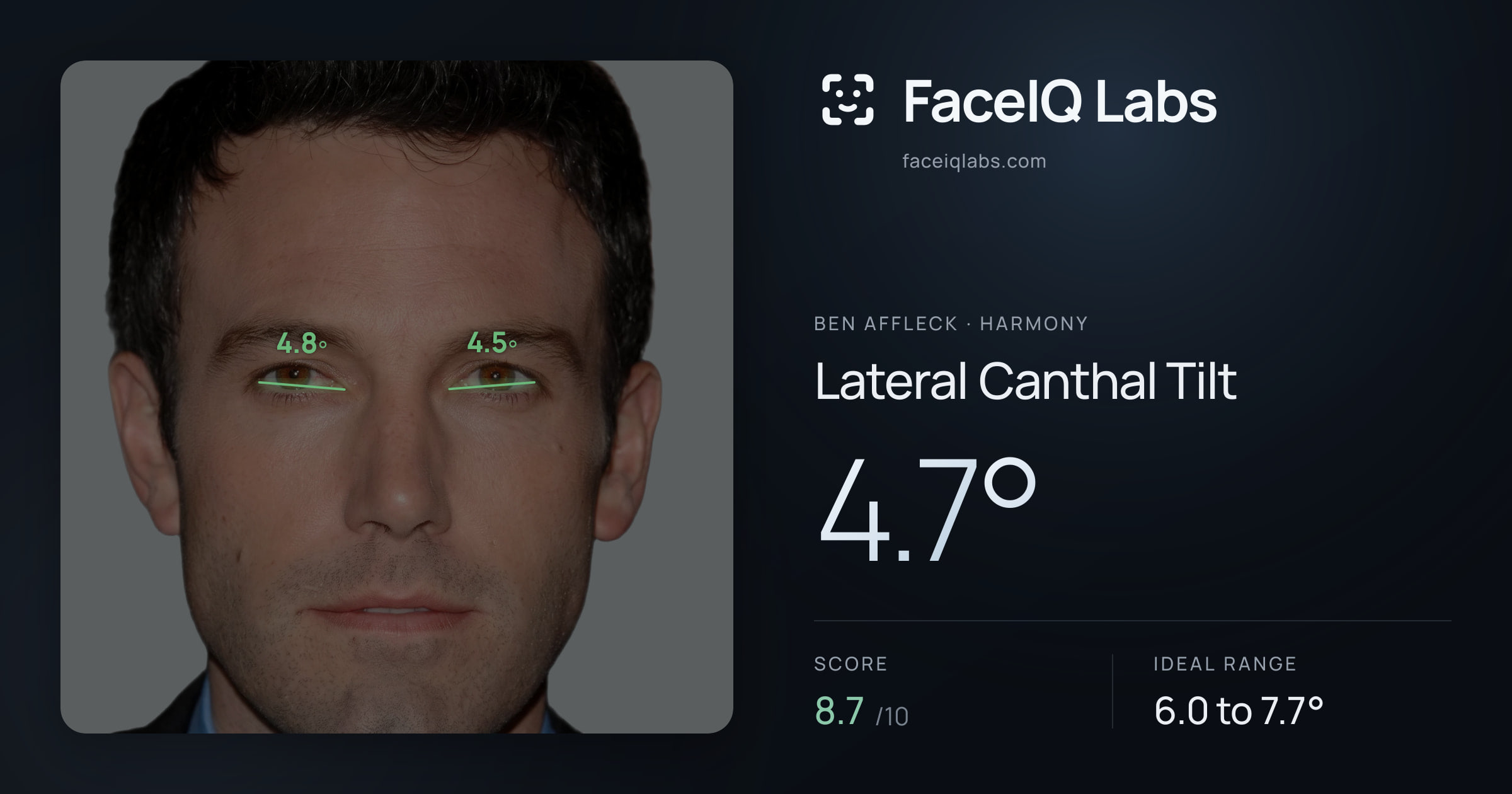 Ben Affleck Lateral Canthal Tilt: 4.7°, drawn on the photo