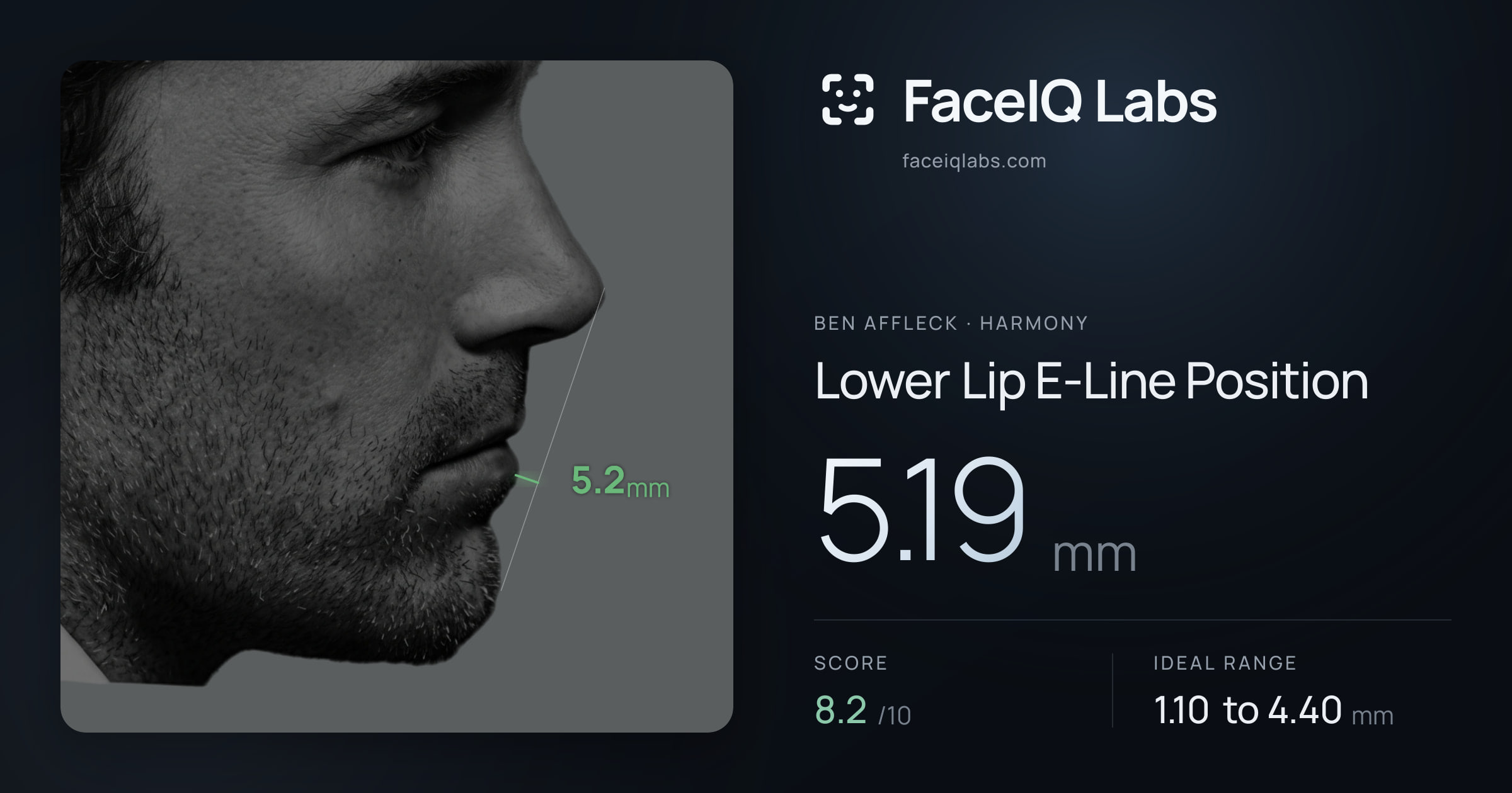 Ben Affleck Lower Lip E-Line Position: 5.19mm, drawn on the photo