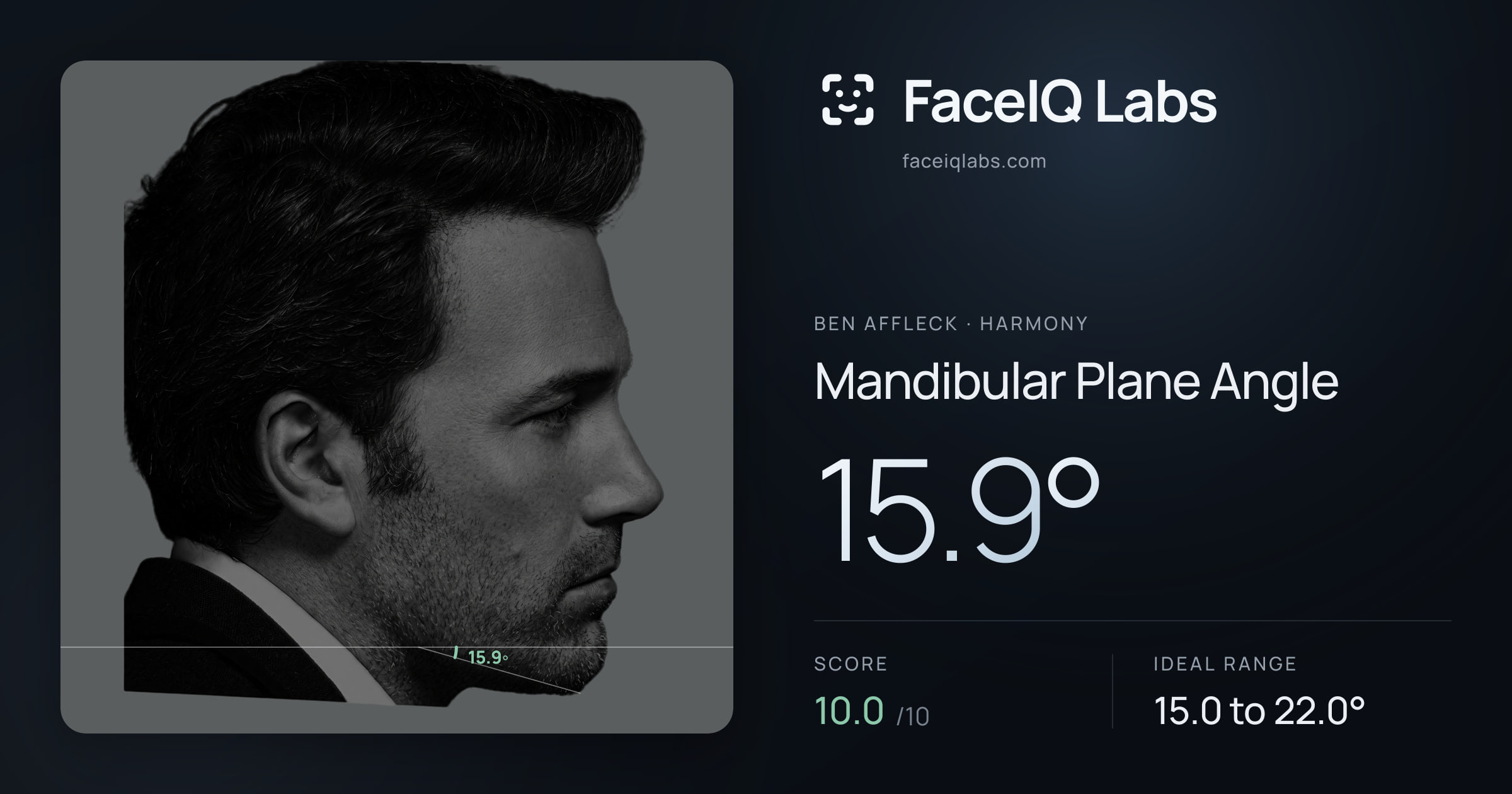 Ben Affleck Mandibular Plane Angle: 15.9°, drawn on the photo