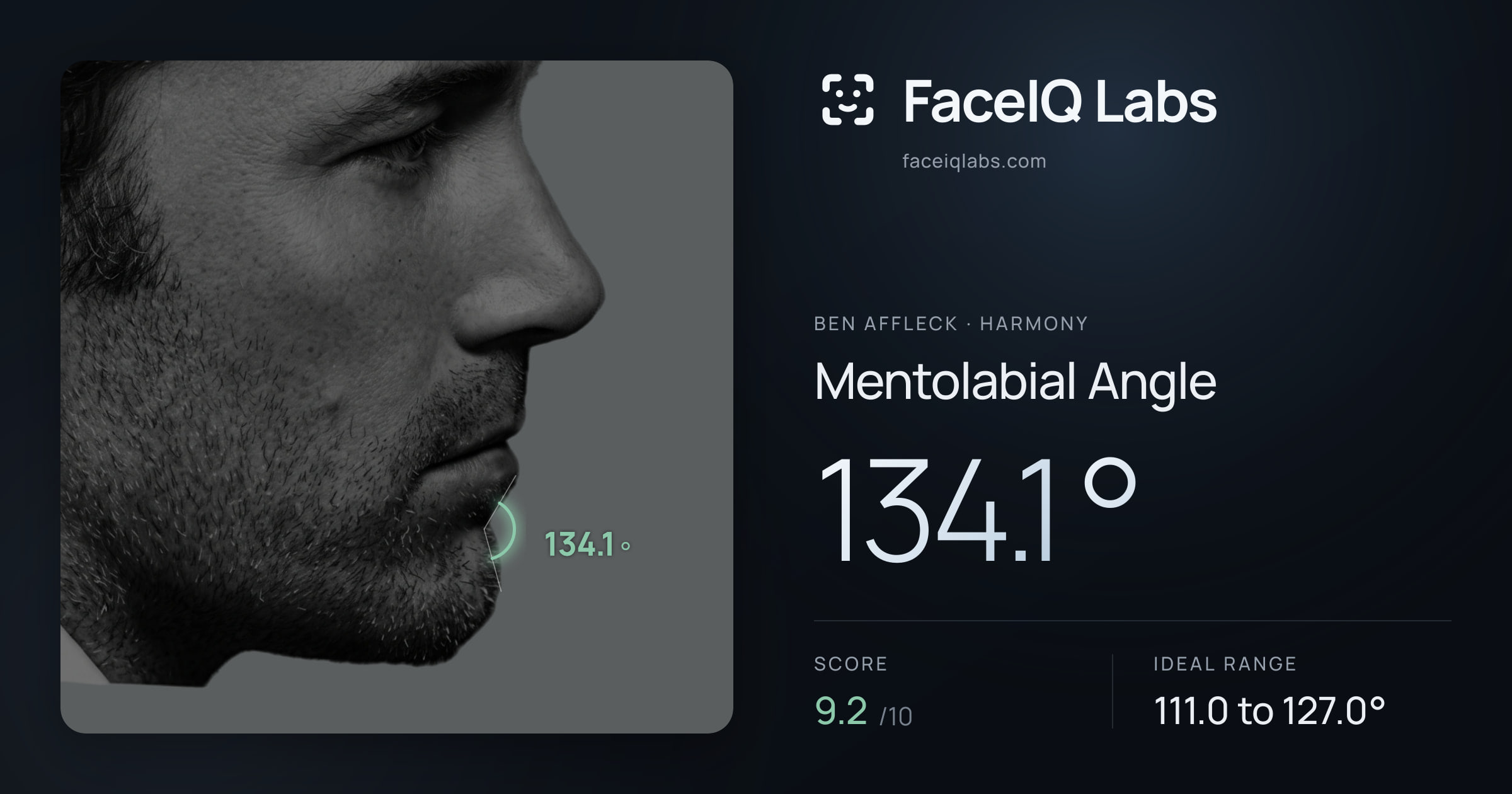 Ben Affleck Mentolabial Angle: 134.1°, drawn on the photo