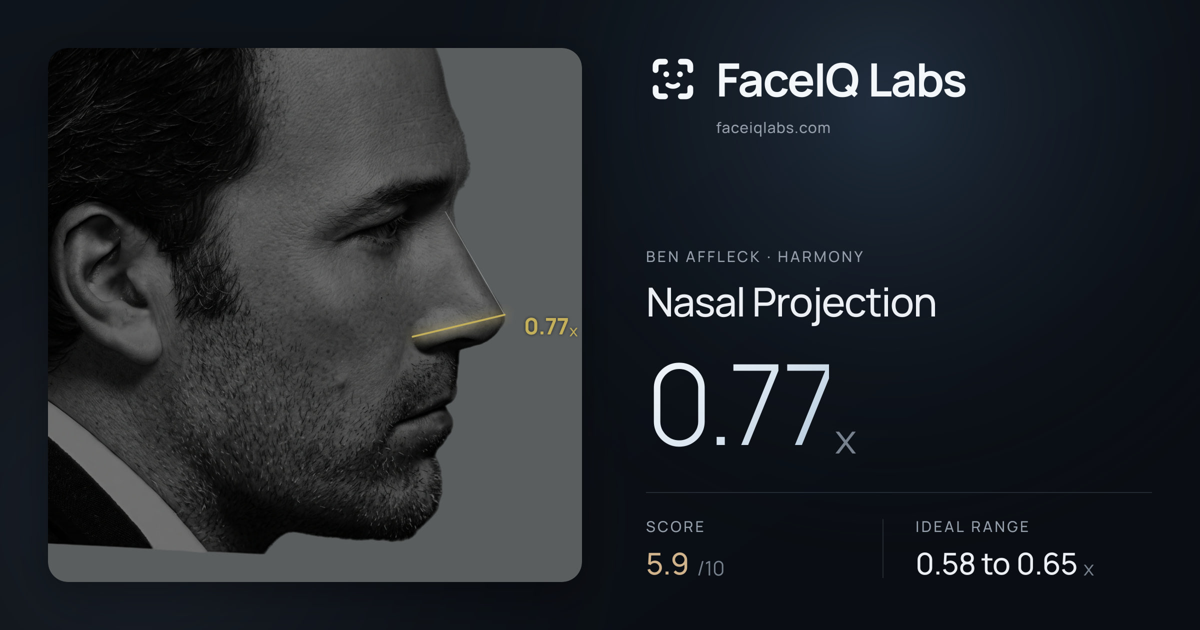 Ben Affleck Nasal Projection: 0.77x, drawn on the photo