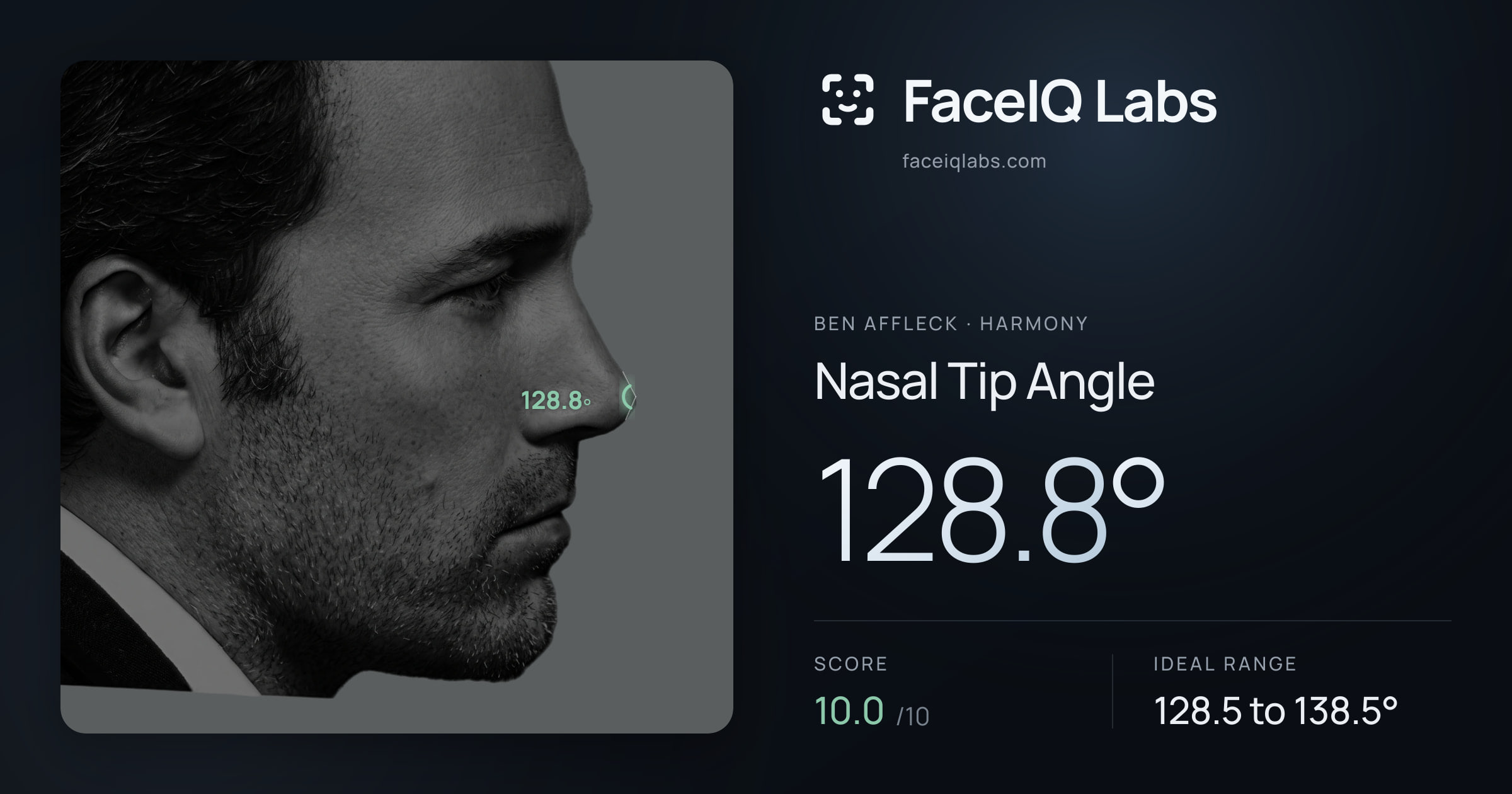 Ben Affleck Nasal Tip Angle: 128.8°, drawn on the photo