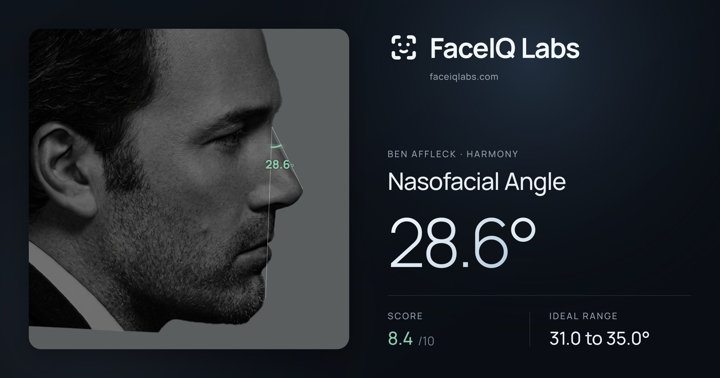 Ben Affleck Nasofacial Angle: 28.6°, drawn on the photo