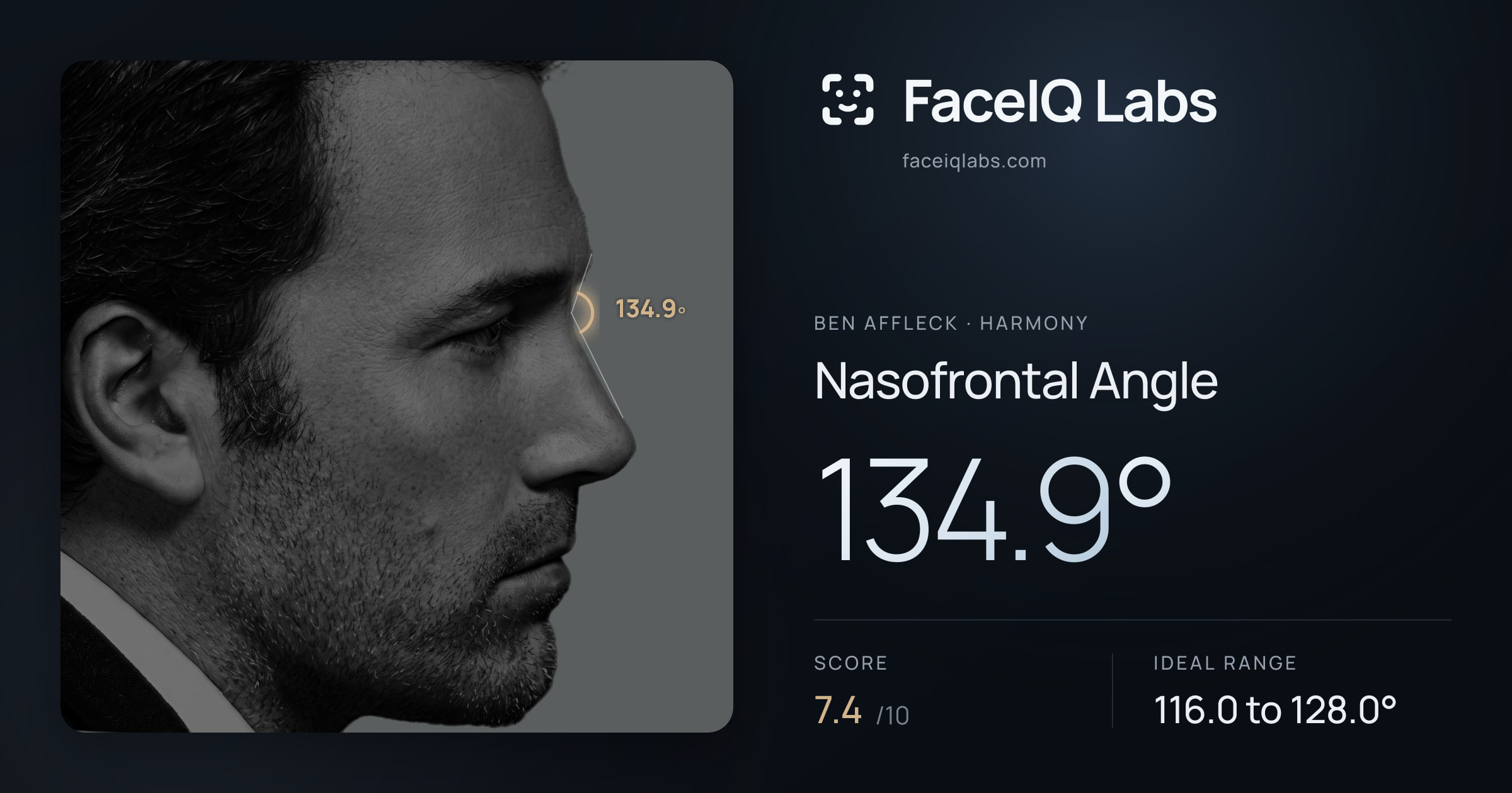 Ben Affleck Nasofrontal Angle: 134.9°, drawn on the photo