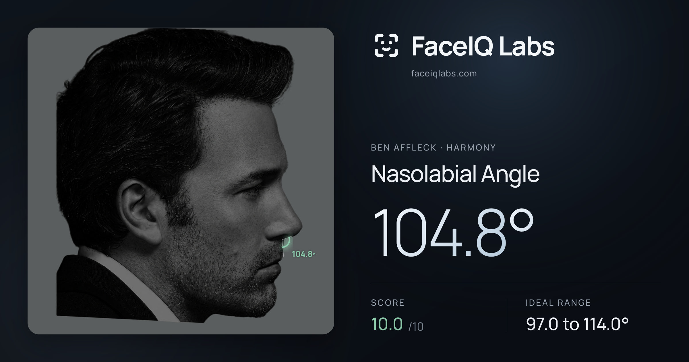 Ben Affleck Nasolabial Angle: 104.8°, drawn on the photo