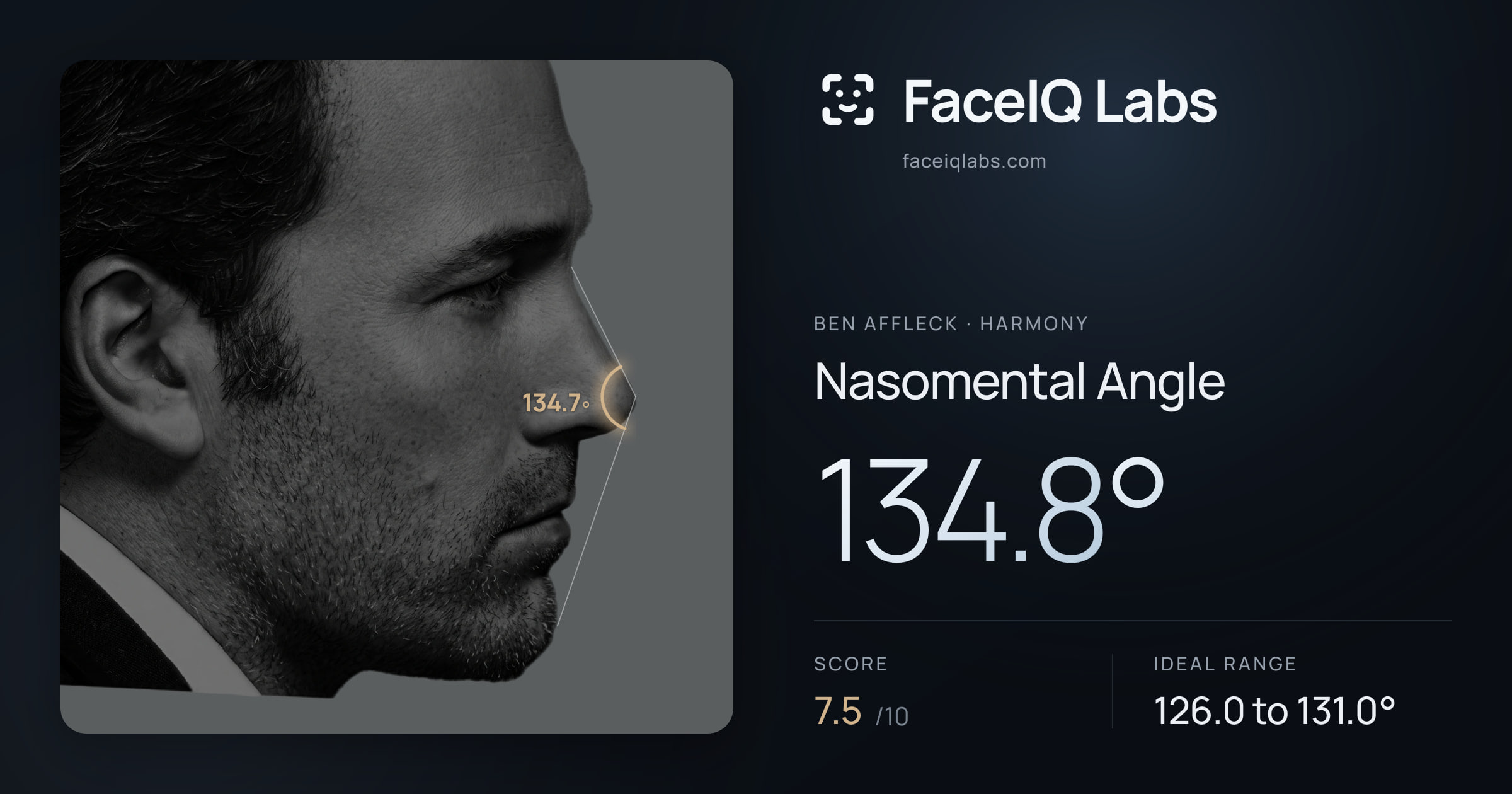 Ben Affleck Nasomental Angle: 134.8°, drawn on the photo