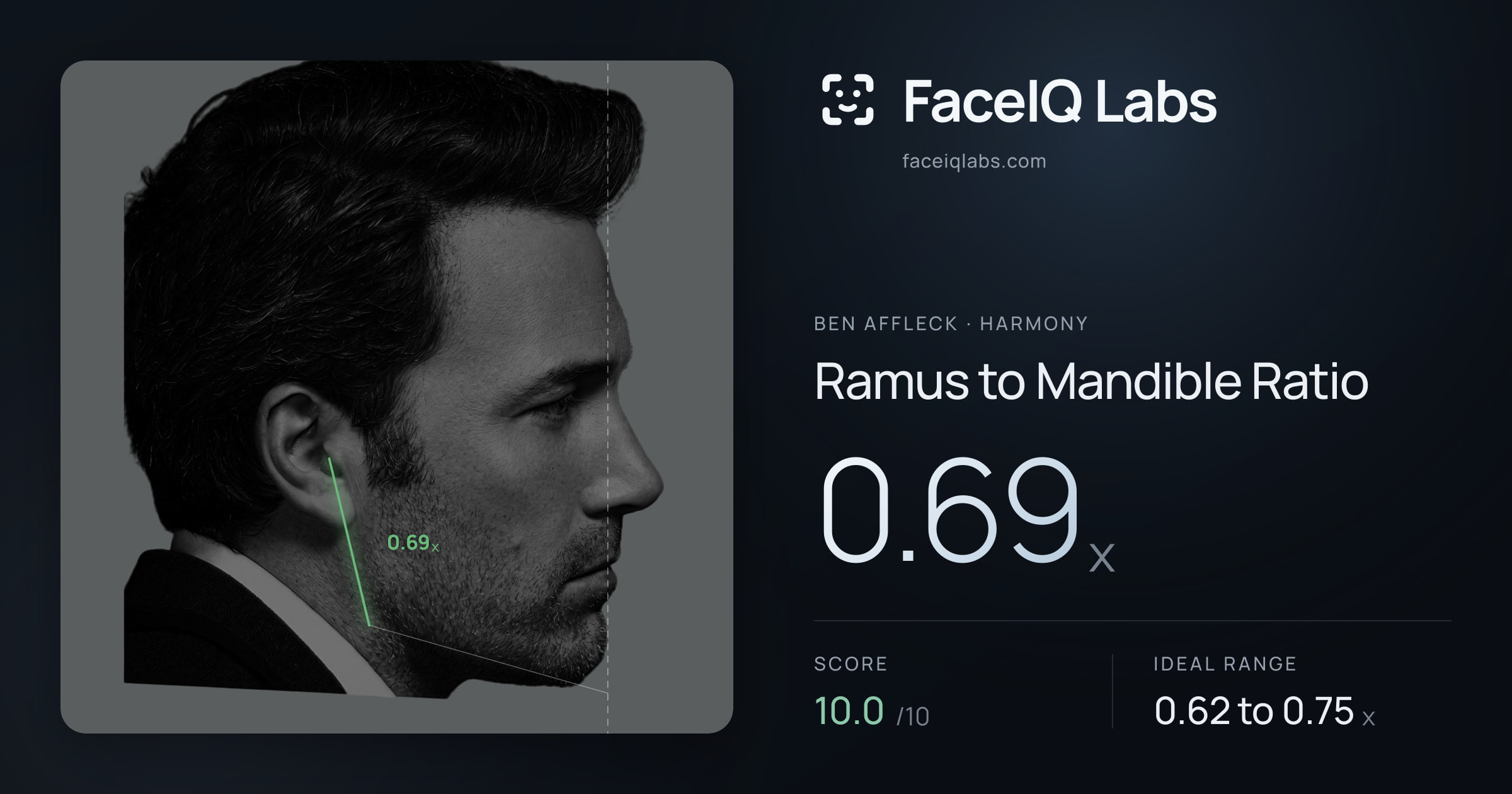 Ben Affleck Ramus to Mandible Ratio: 0.69x, drawn on the photo