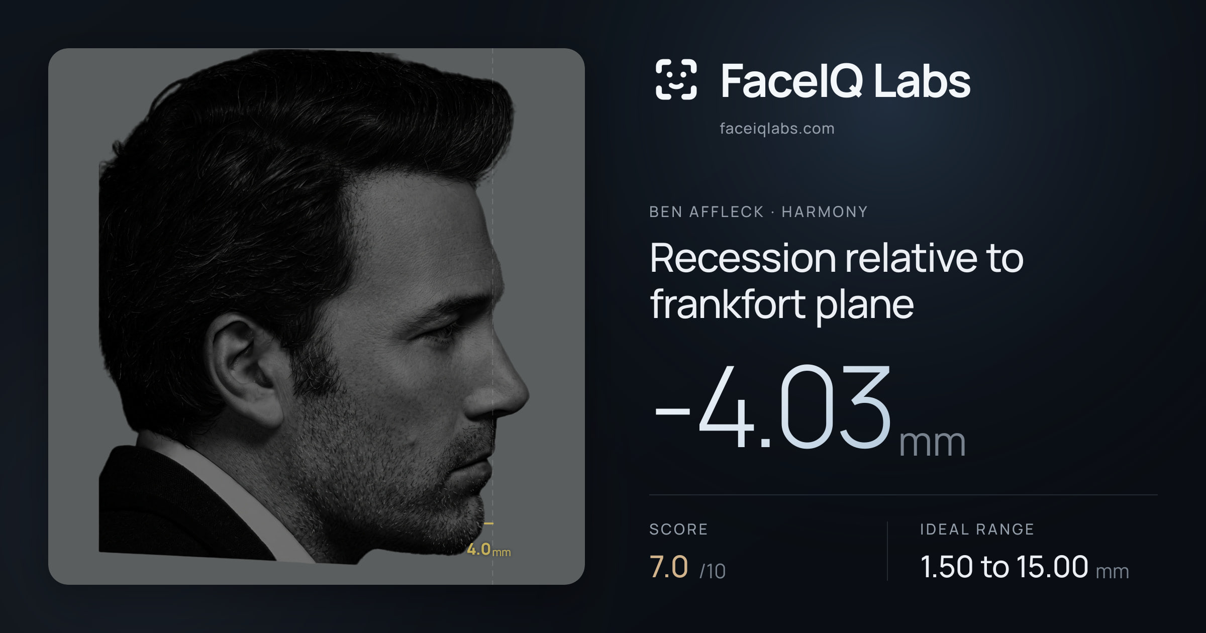 Ben Affleck Recession relative to frankfort plane: -4.03mm, drawn on the photo