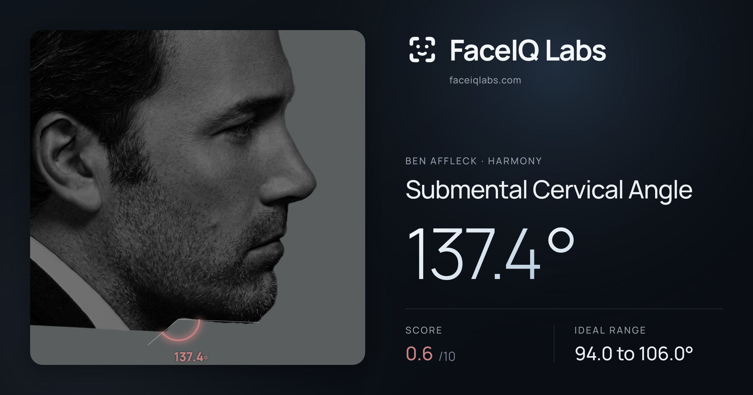 Ben Affleck Submental Cervical Angle: 137.4°, drawn on the photo