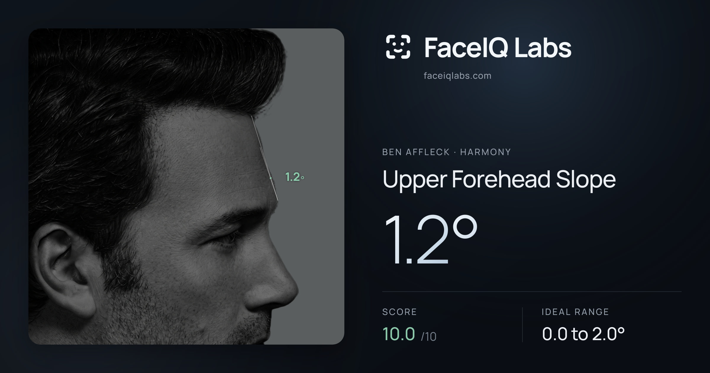 Ben Affleck Upper Forehead Slope: 1.2°, drawn on the photo