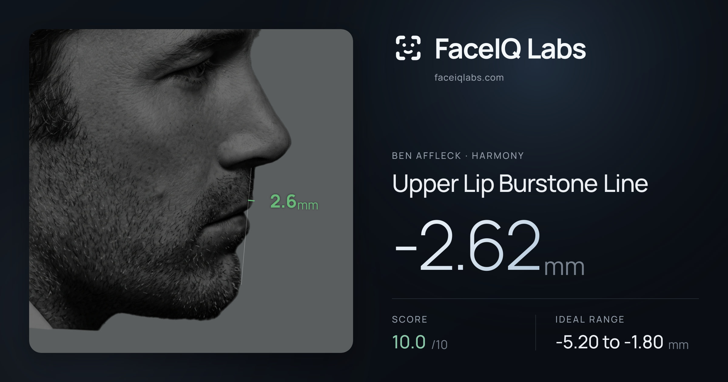 Ben Affleck Upper Lip Burstone Line: -2.62mm, drawn on the photo