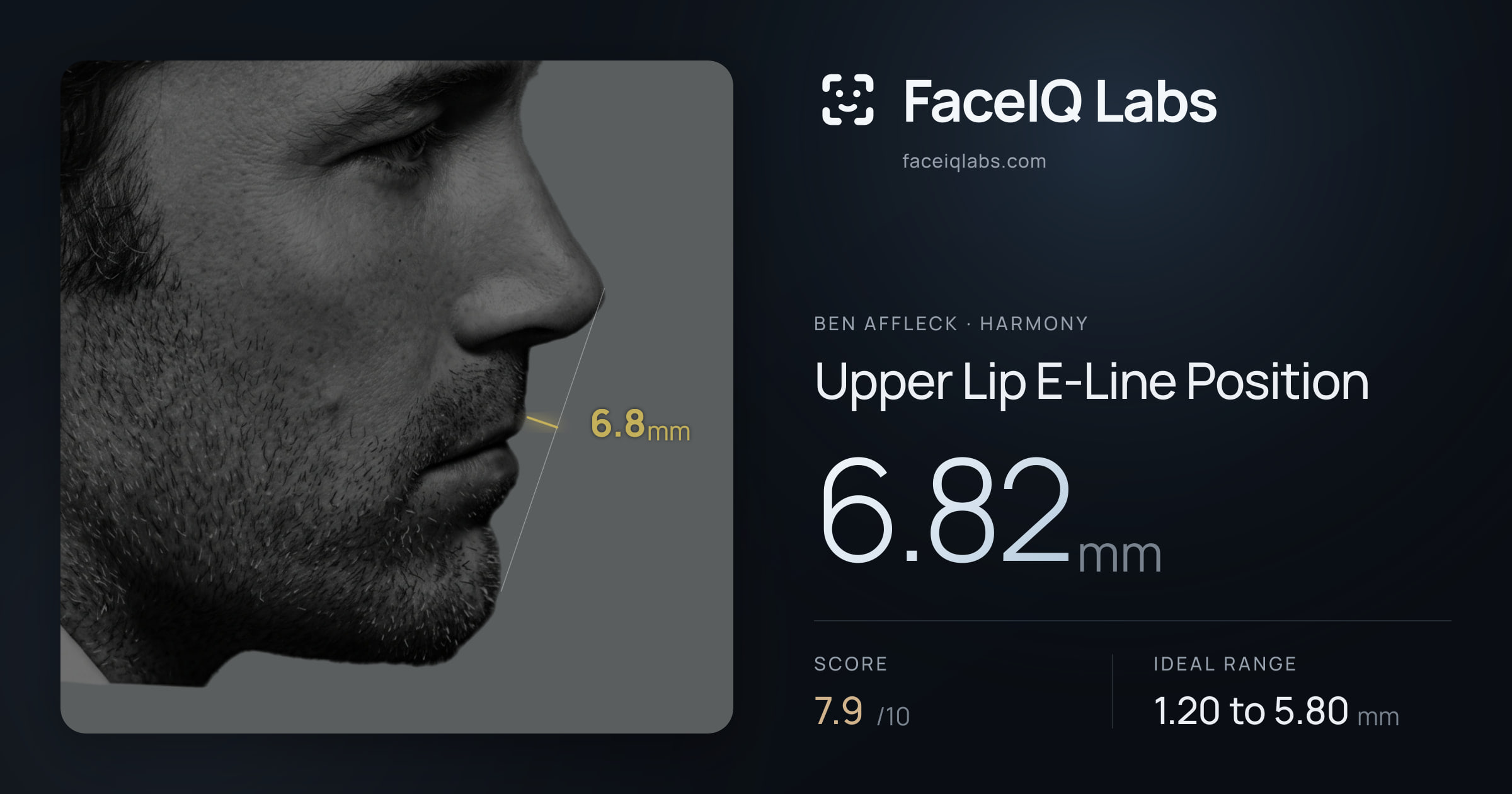Ben Affleck Upper Lip E-Line Position: 6.82mm, drawn on the photo