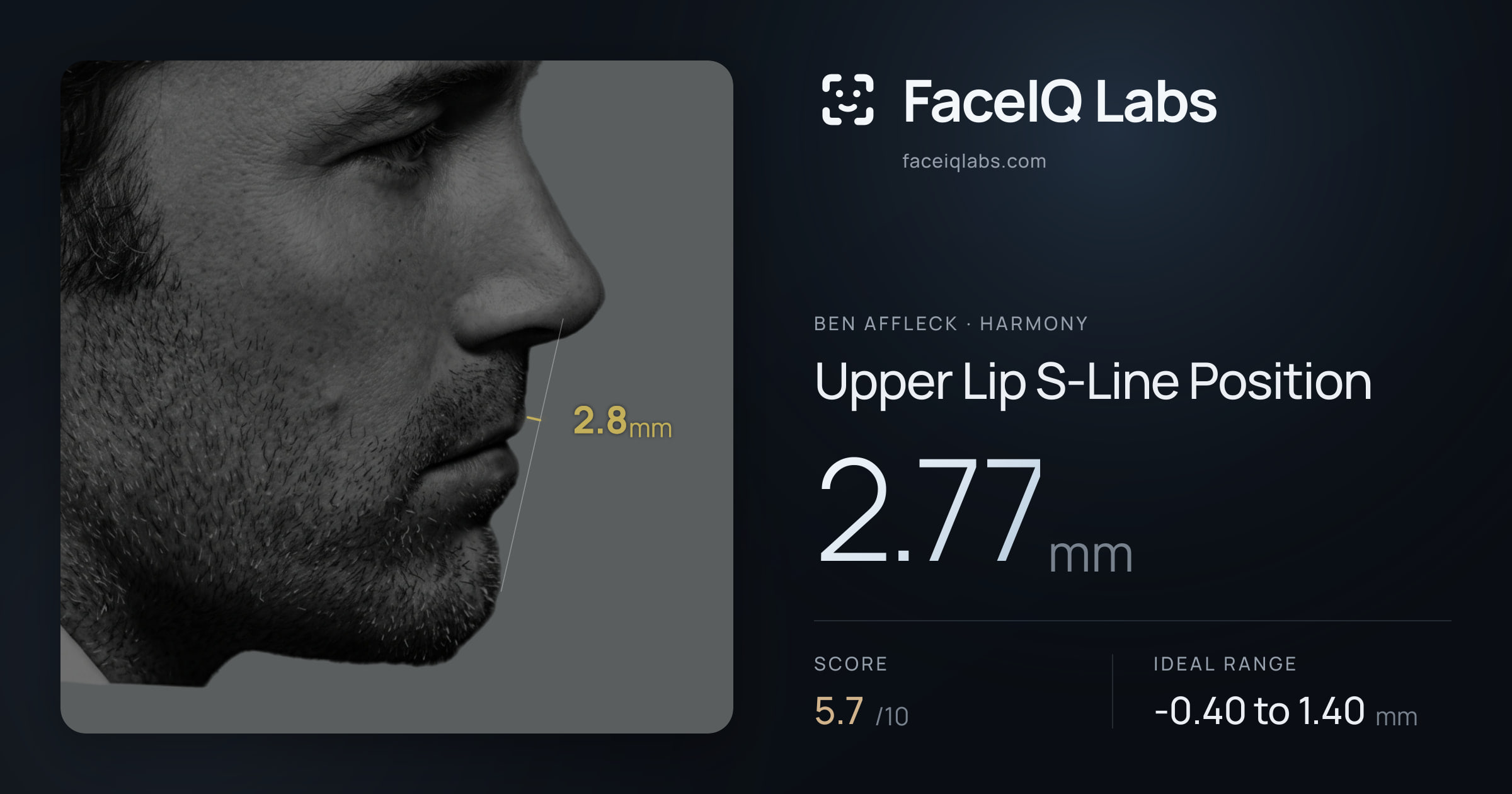 Ben Affleck Upper Lip S-Line Position: 2.77mm, drawn on the photo