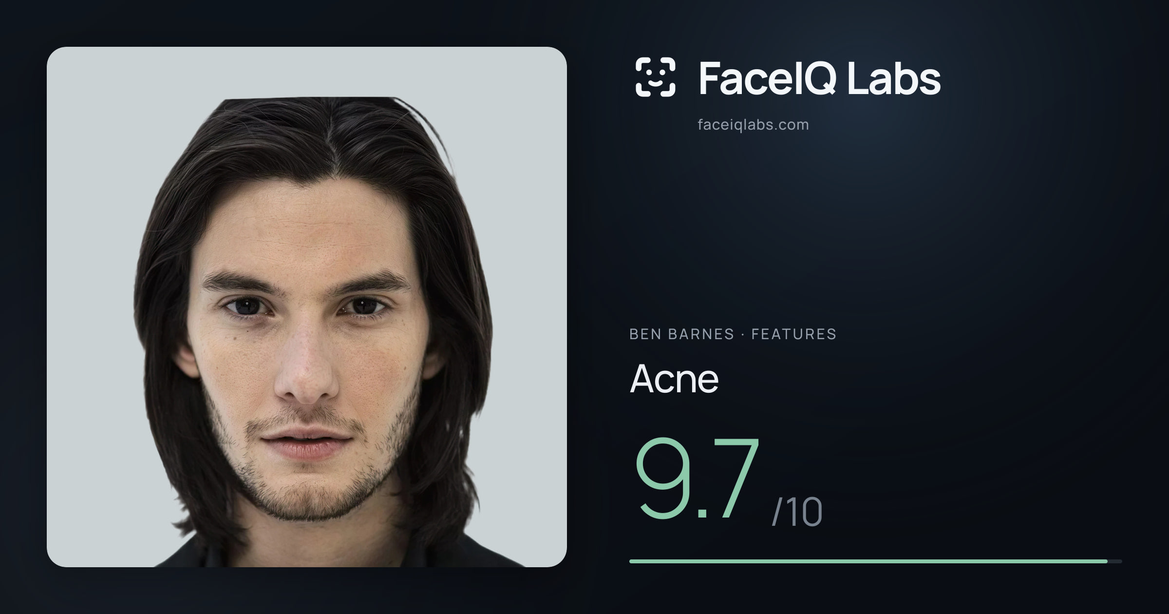 Ben Barnes Acne: 9.7/10, drawn on the photo