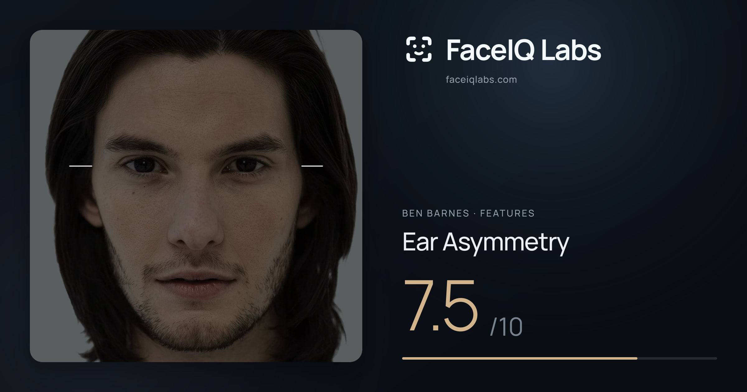 Ben Barnes Ear Asymmetry: 7.5/10, drawn on the photo