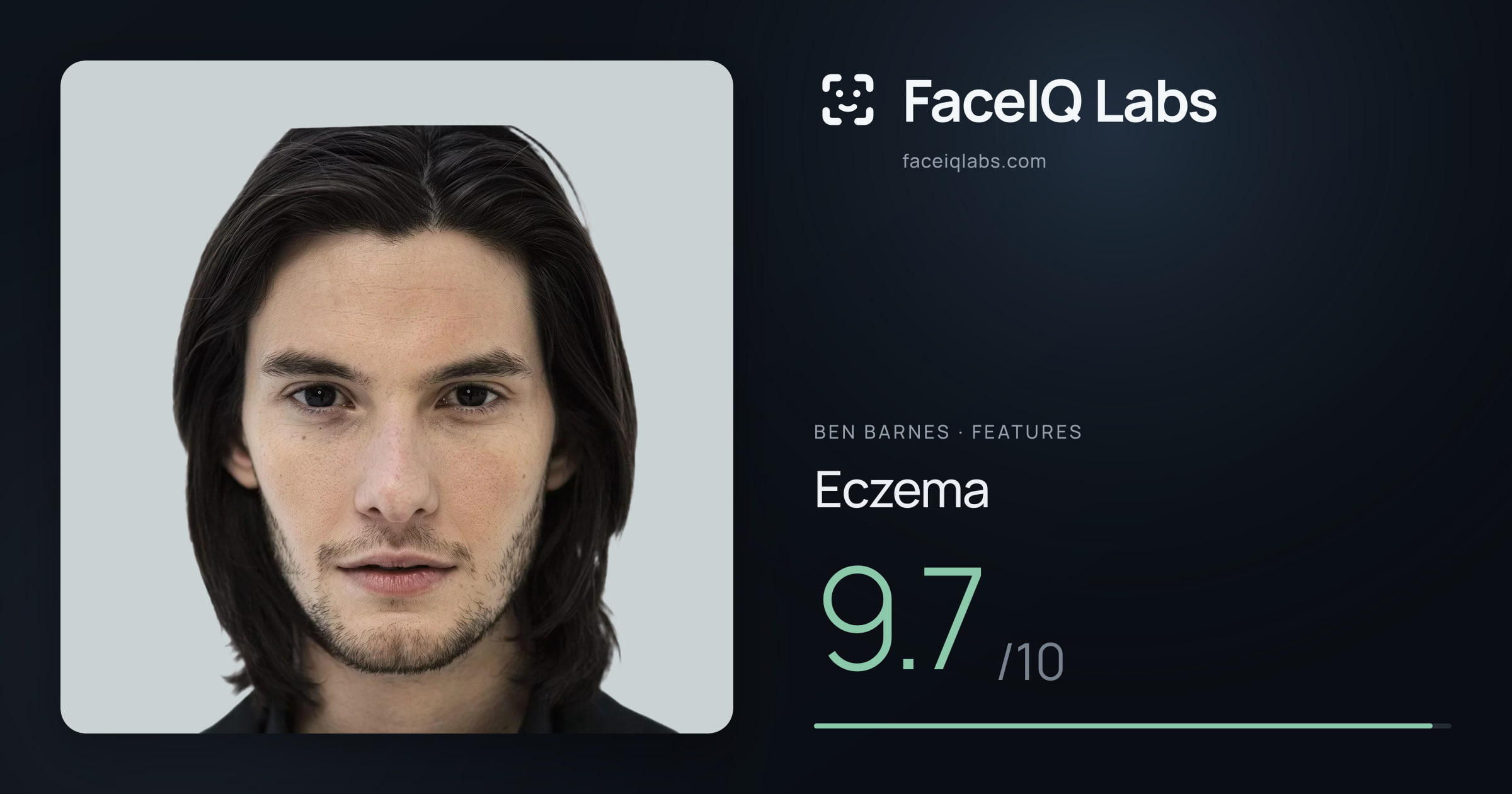 Ben Barnes Eczema: 9.7/10, drawn on the photo