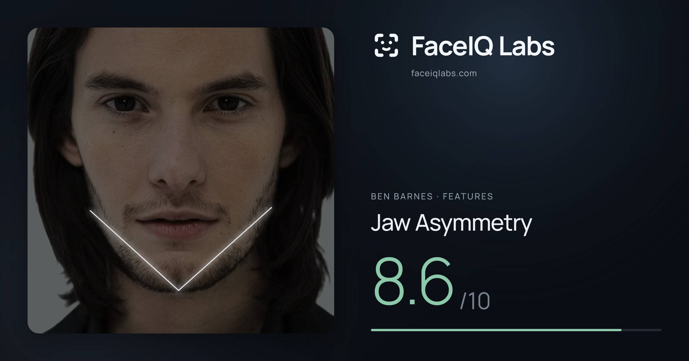 Ben Barnes Jaw Asymmetry: 8.6/10, drawn on the photo