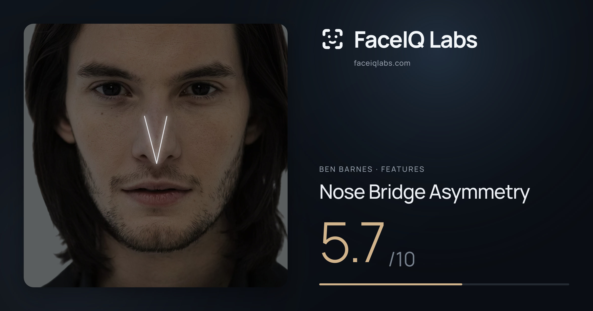 Ben Barnes Nose Bridge Asymmetry: 5.7/10, drawn on the photo