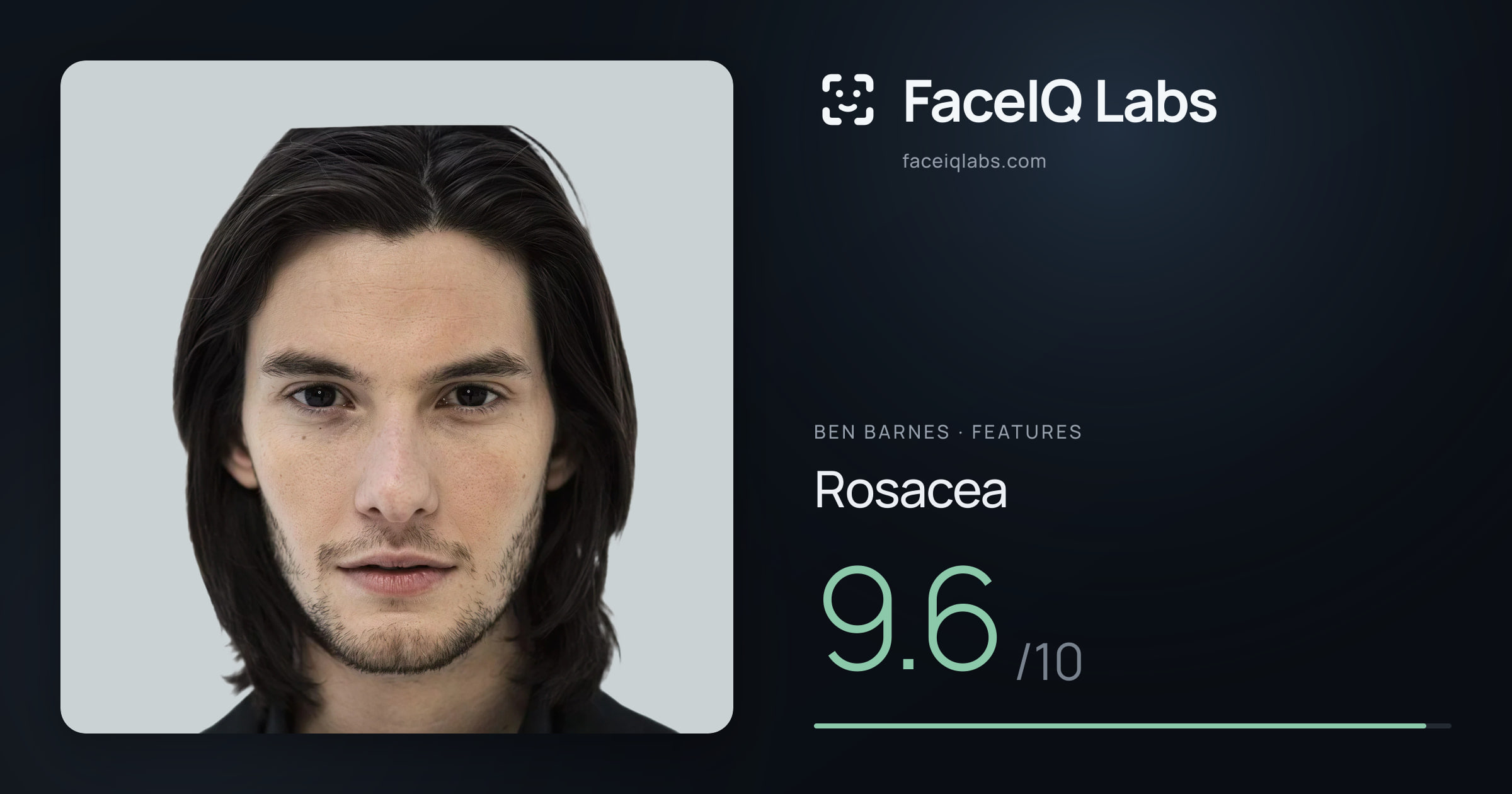 Ben Barnes Rosacea: 9.6/10, drawn on the photo