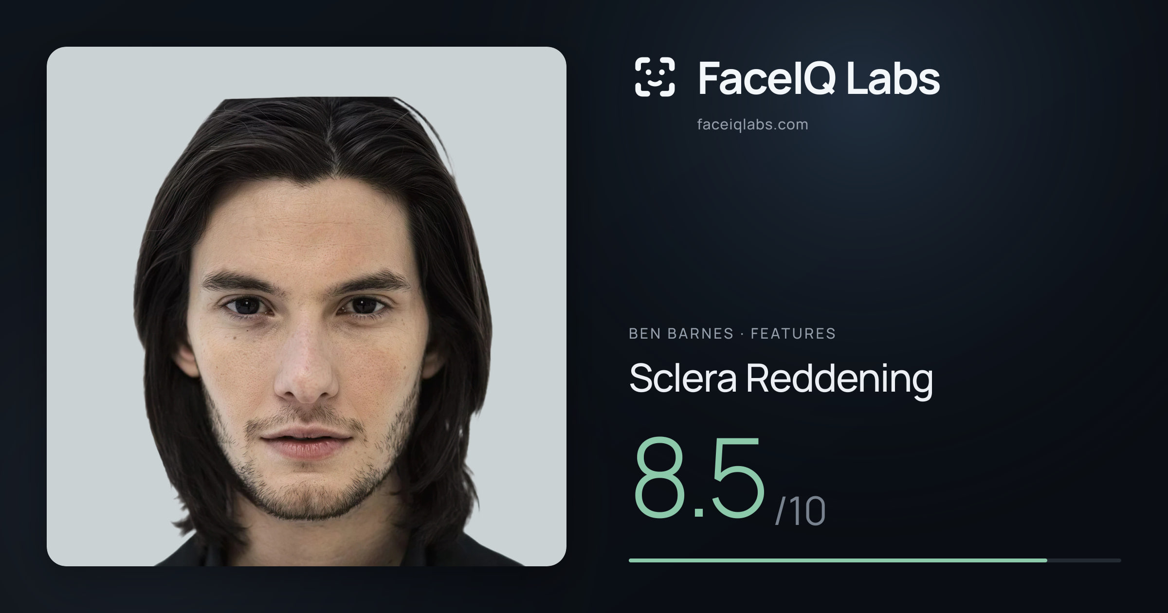 Ben Barnes Sclera Reddening: 8.5/10, drawn on the photo