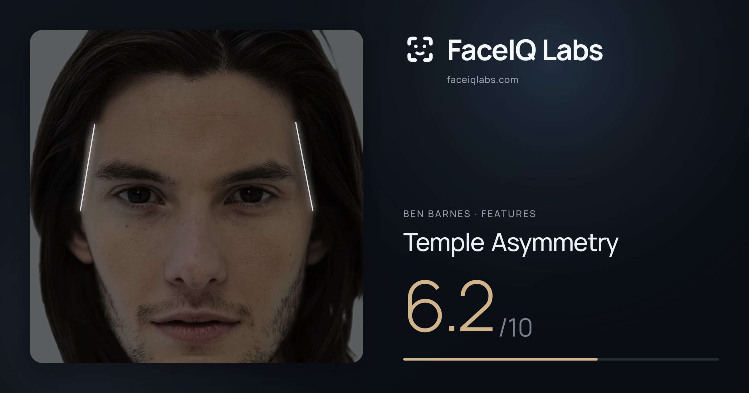 Ben Barnes Temple Asymmetry: 6.2/10, drawn on the photo