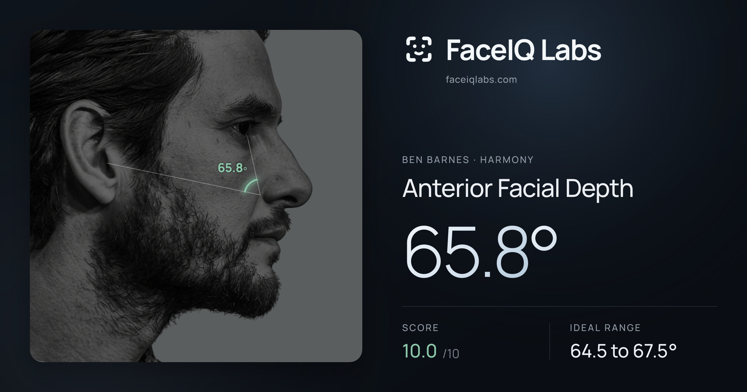 Ben Barnes Anterior Facial Depth: 65.8°, drawn on the photo