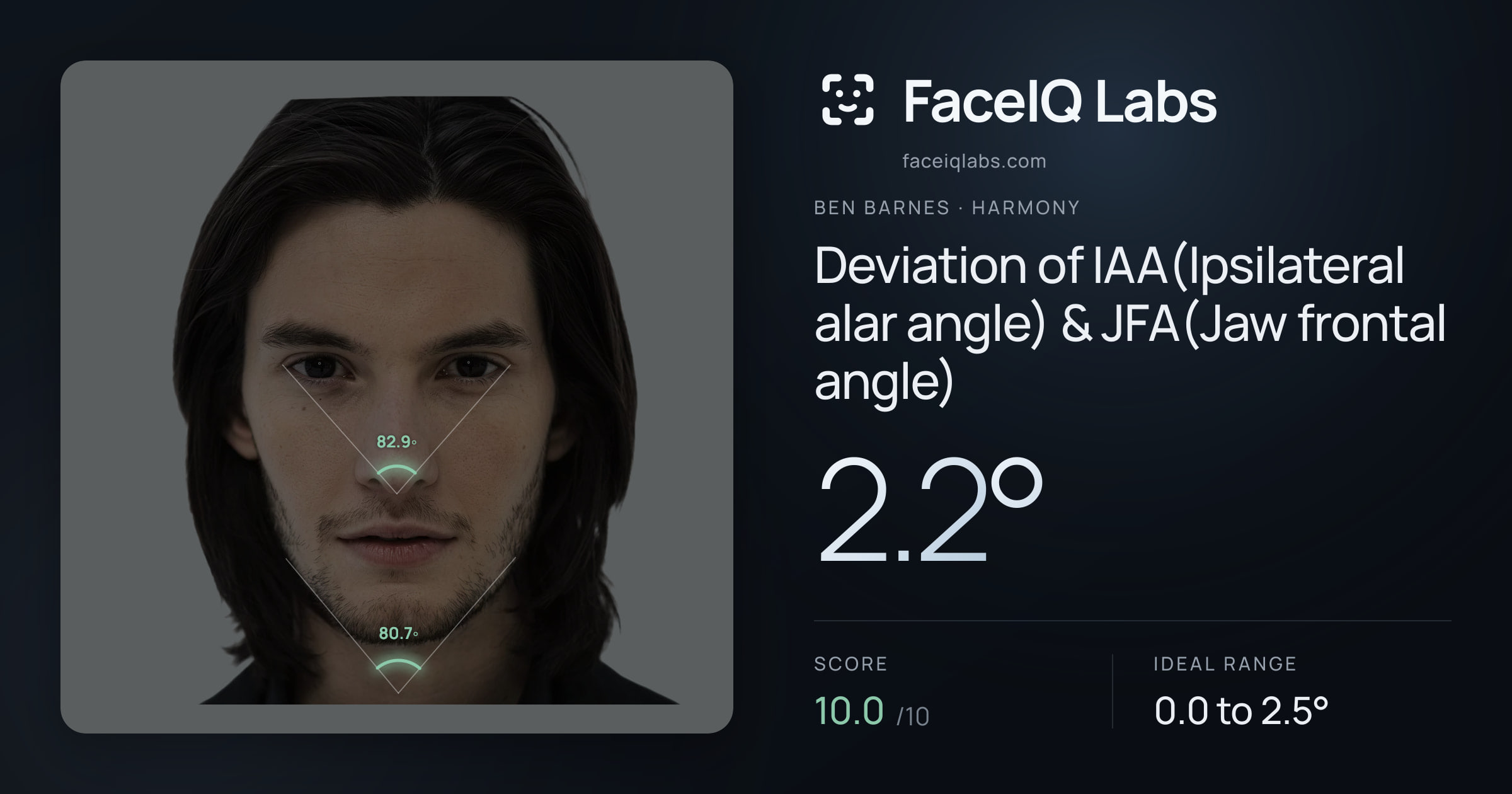 Ben Barnes Deviation of IAA(Ipsilateral alar angle) & JFA(Jaw frontal angle): 2.2°, drawn on the photo