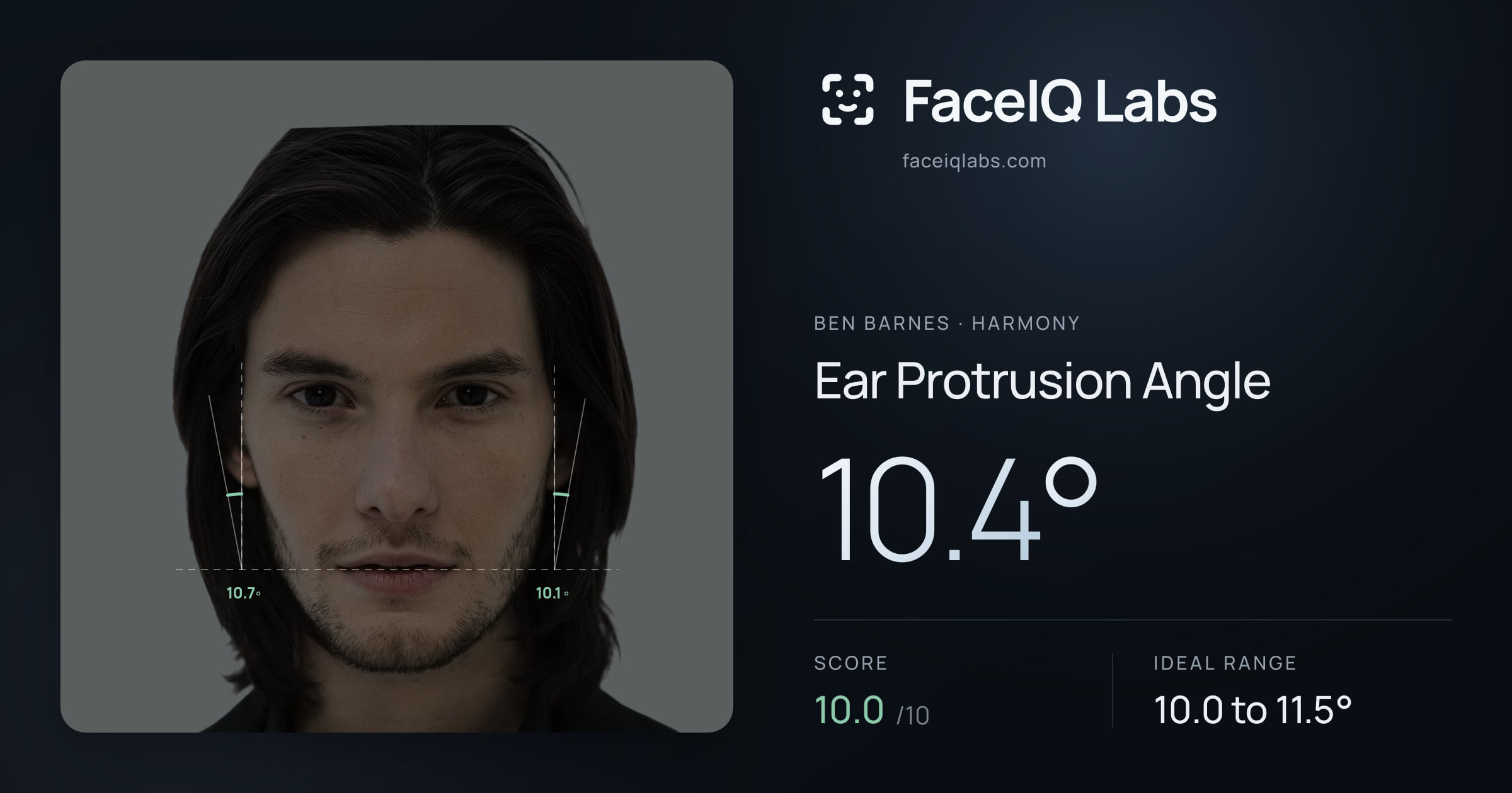 Ben Barnes Ear Protrusion Angle: 10.4°, drawn on the photo