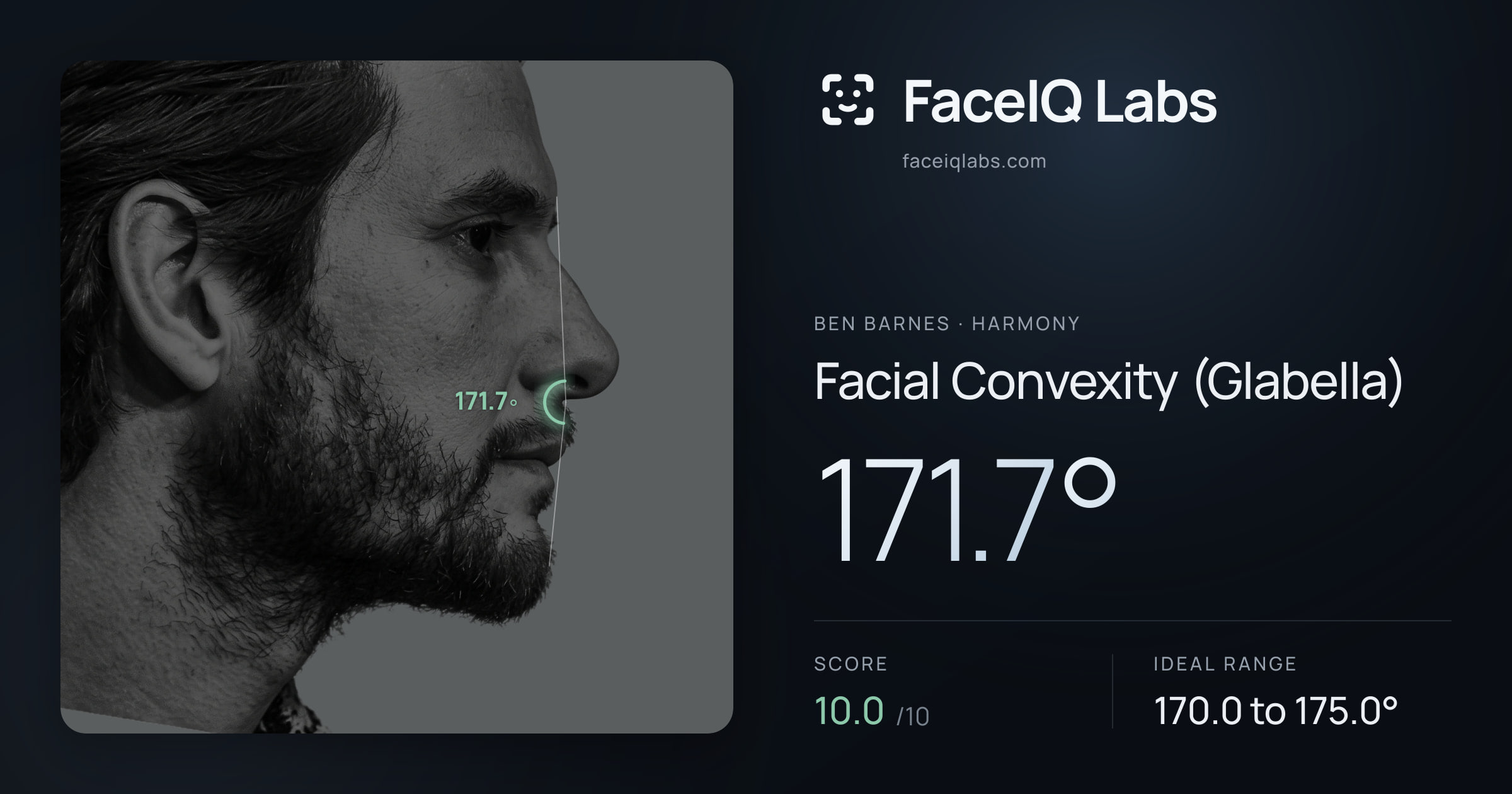 Ben Barnes Facial Convexity (Glabella): 171.7°, drawn on the photo