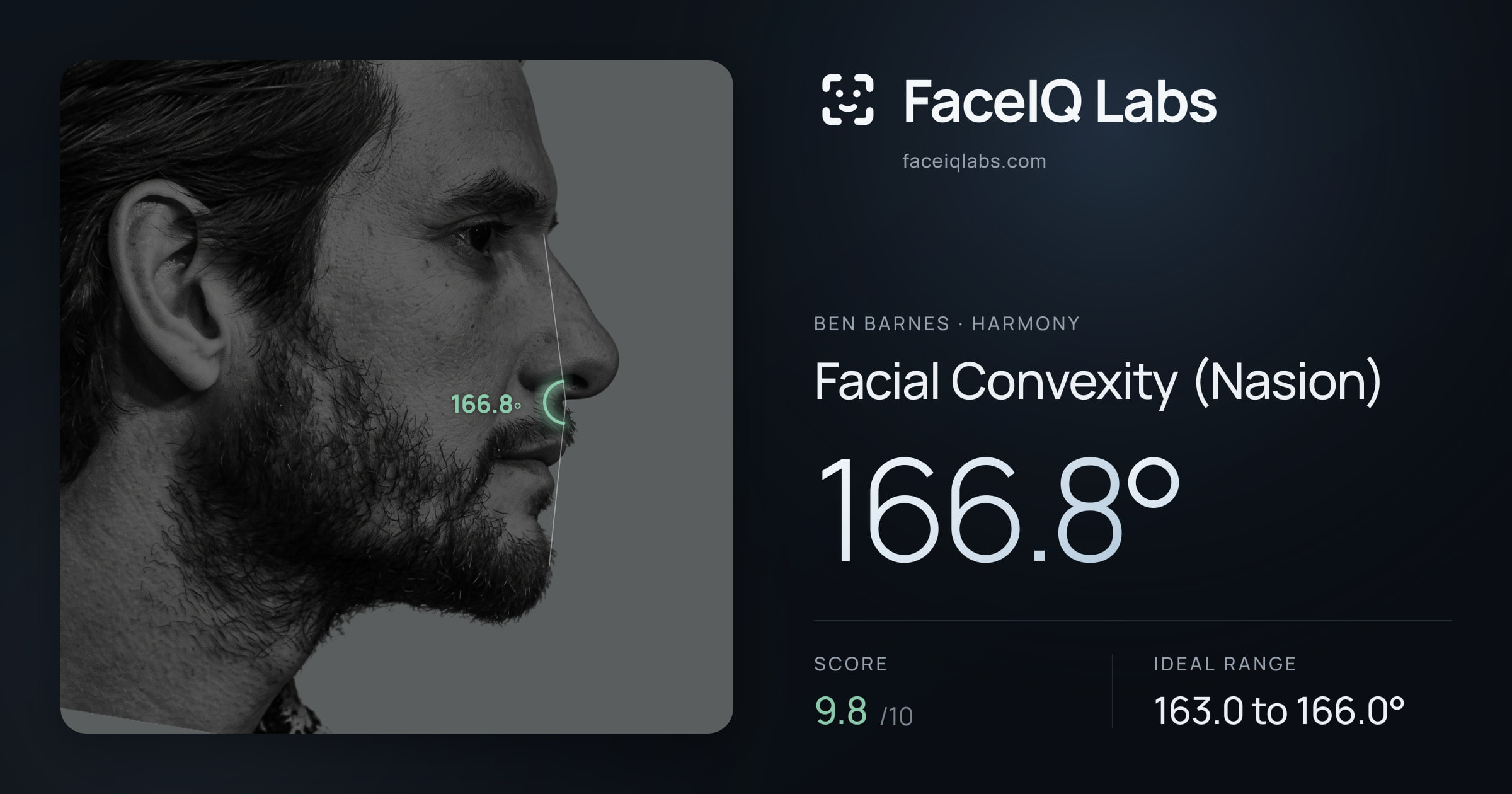 Ben Barnes Facial Convexity (Nasion): 166.8°, drawn on the photo