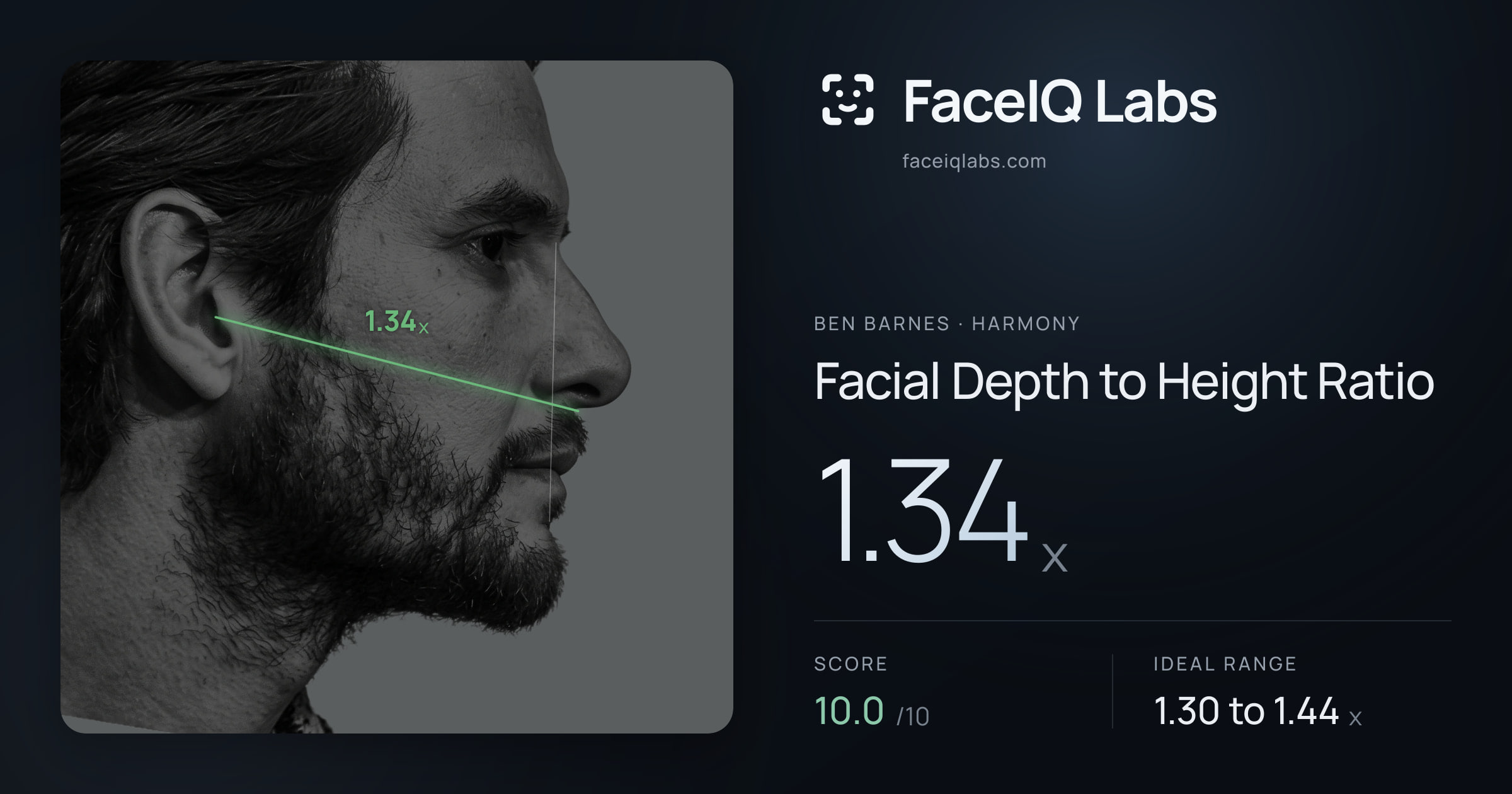 Ben Barnes Facial Depth to Height Ratio: 1.34x, drawn on the photo