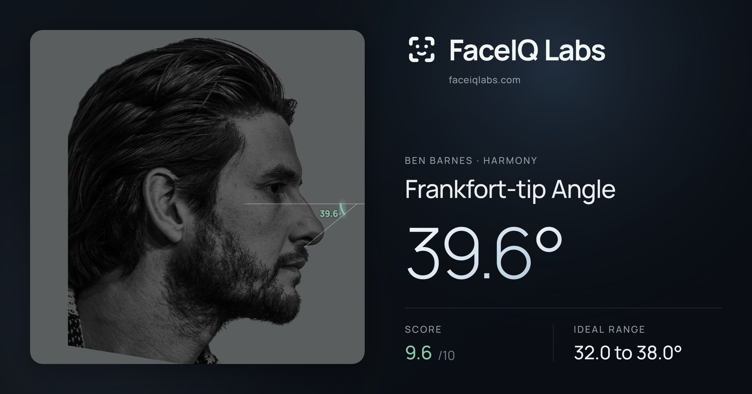Ben Barnes Frankfort-tip Angle: 39.6°, drawn on the photo