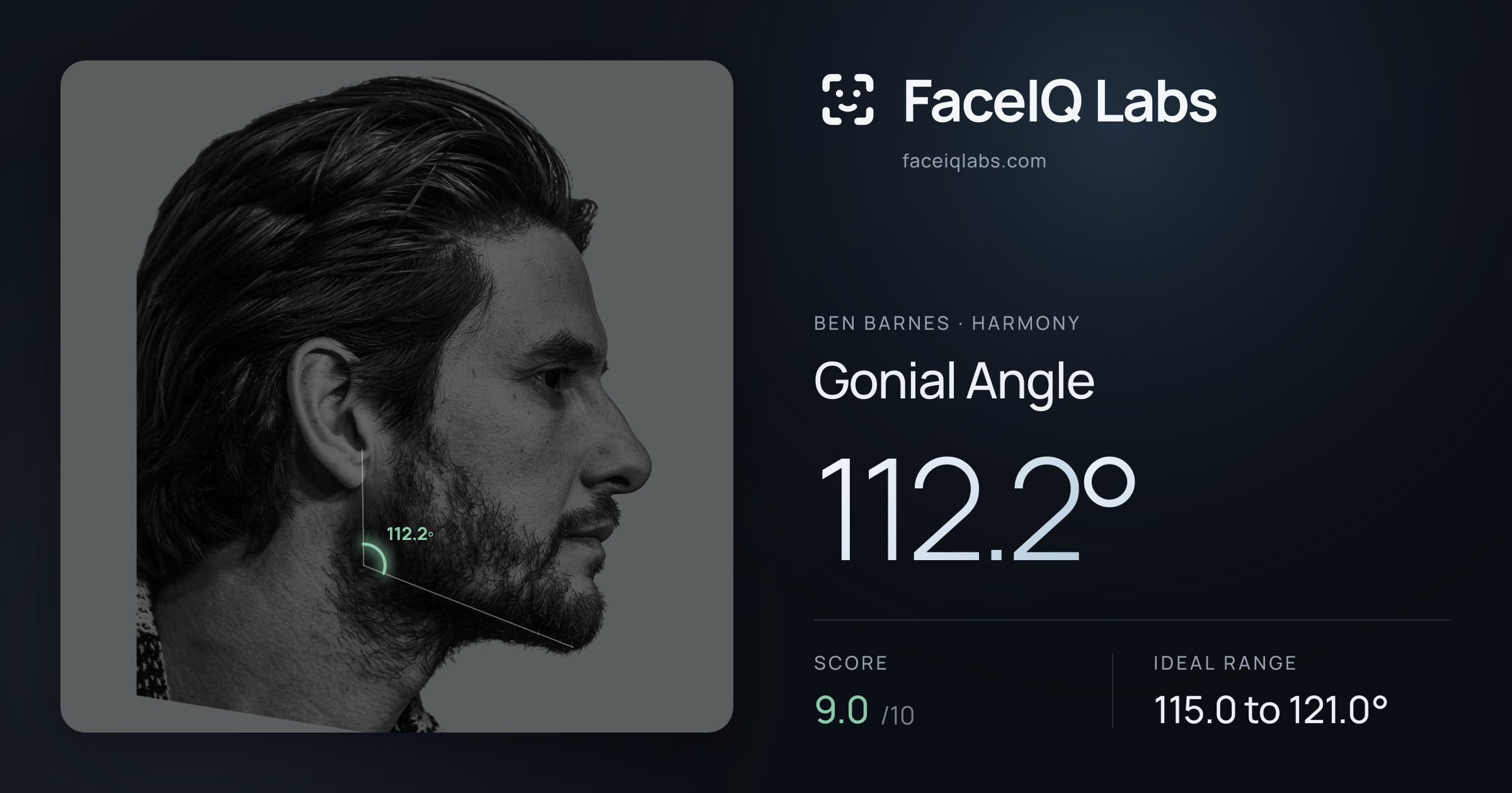 Ben Barnes Gonial Angle: 112.2°, drawn on the photo