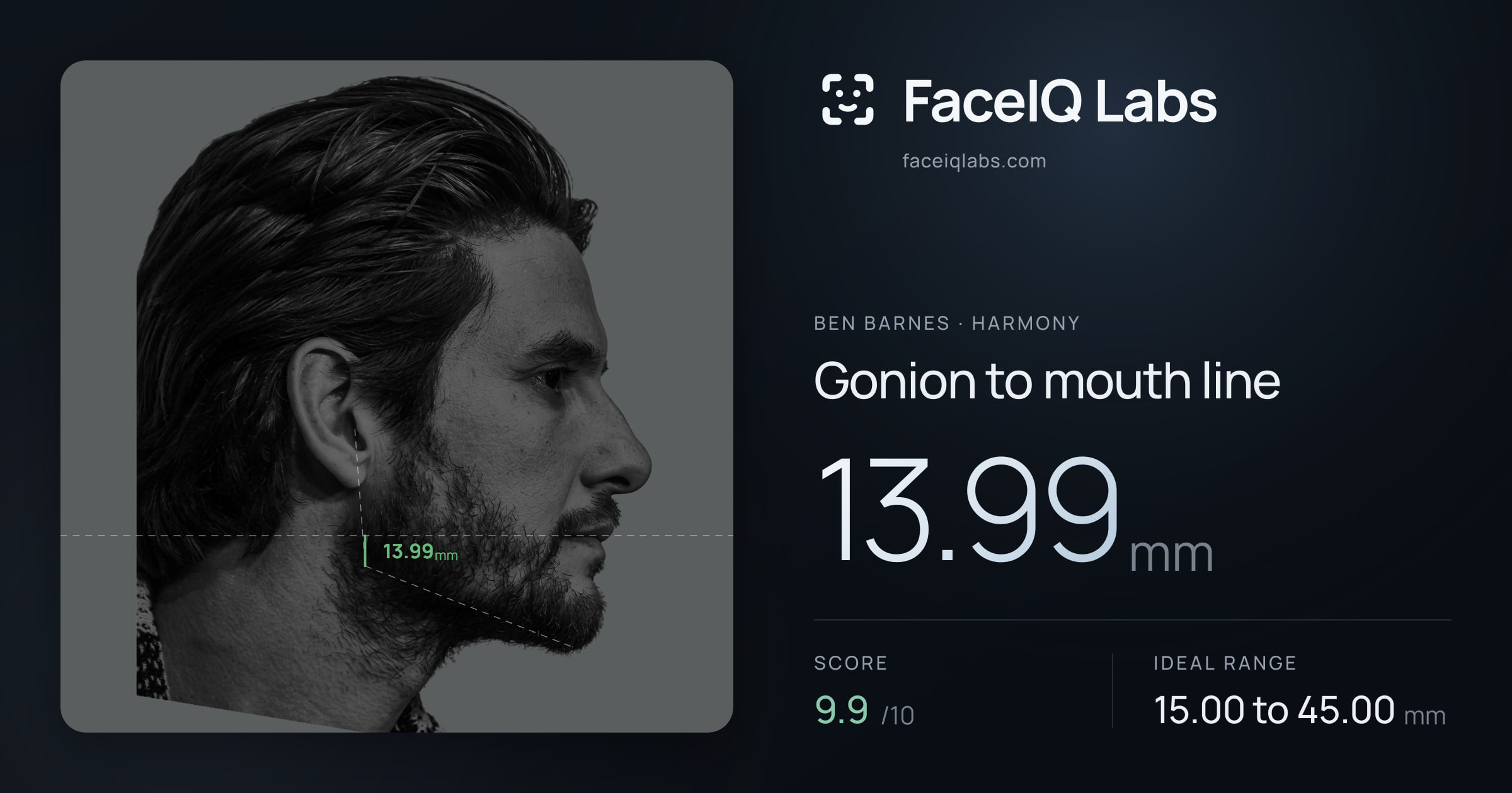 Ben Barnes Gonion to mouth line: 13.99mm, drawn on the photo