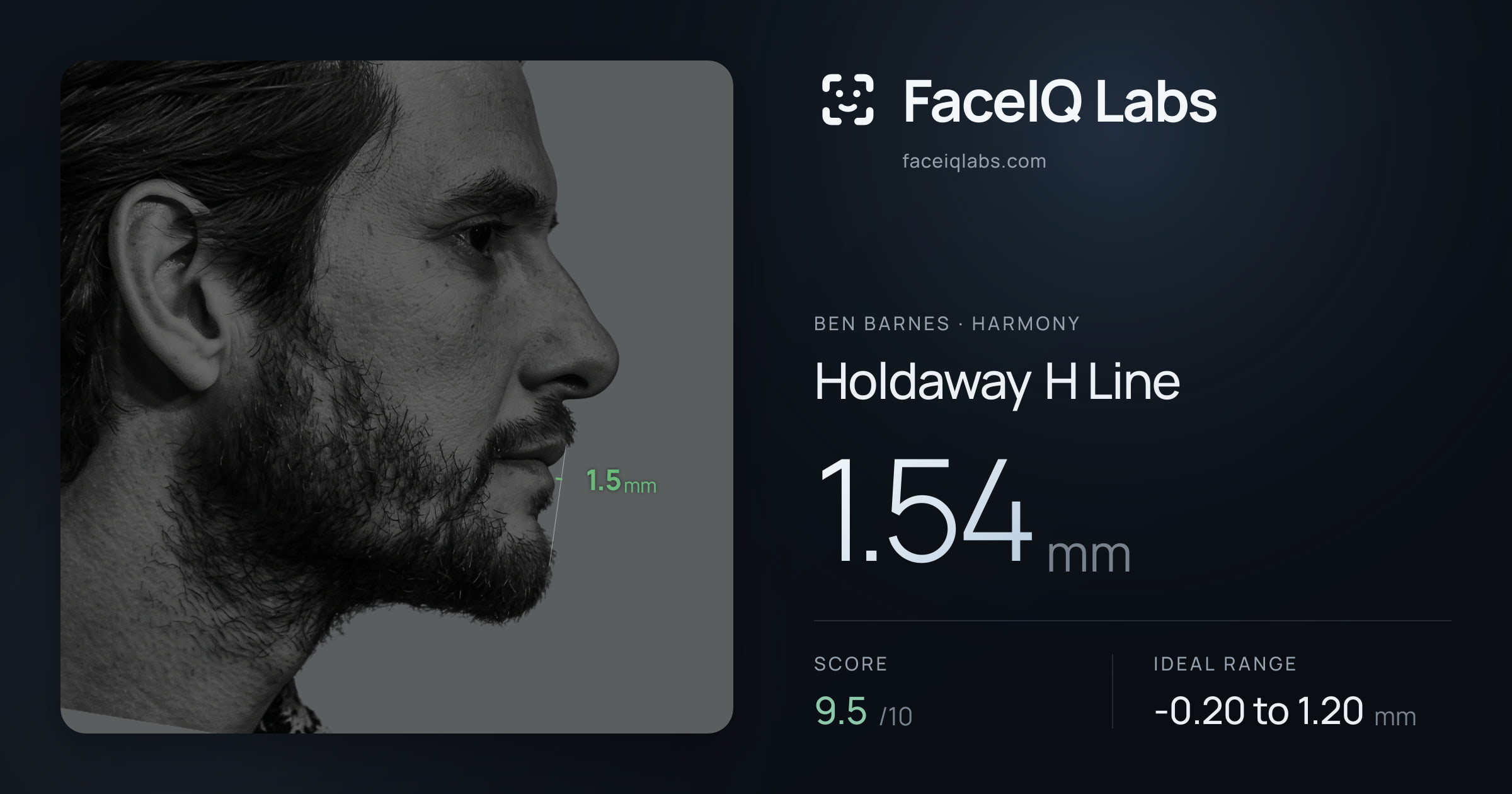 Ben Barnes Holdaway H Line: 1.54mm, drawn on the photo