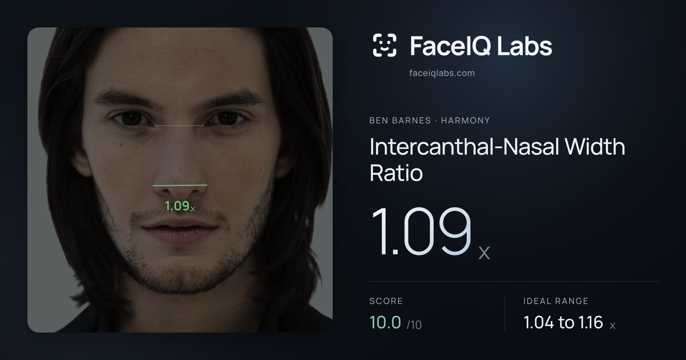 Ben Barnes Intercanthal-Nasal Width Ratio: 1.09x, drawn on the photo