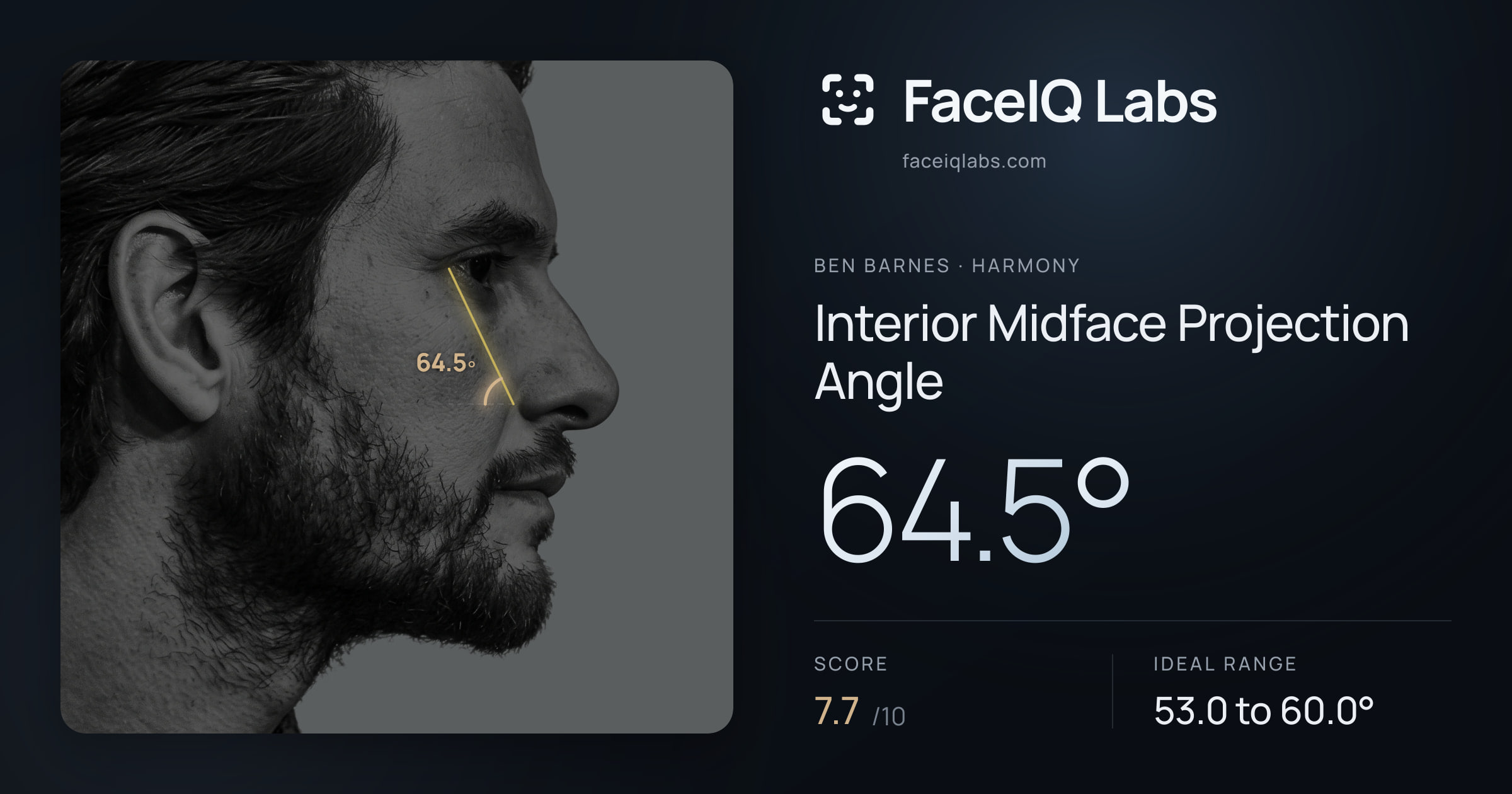 Ben Barnes Interior Midface Projection Angle: 64.5°, drawn on the photo