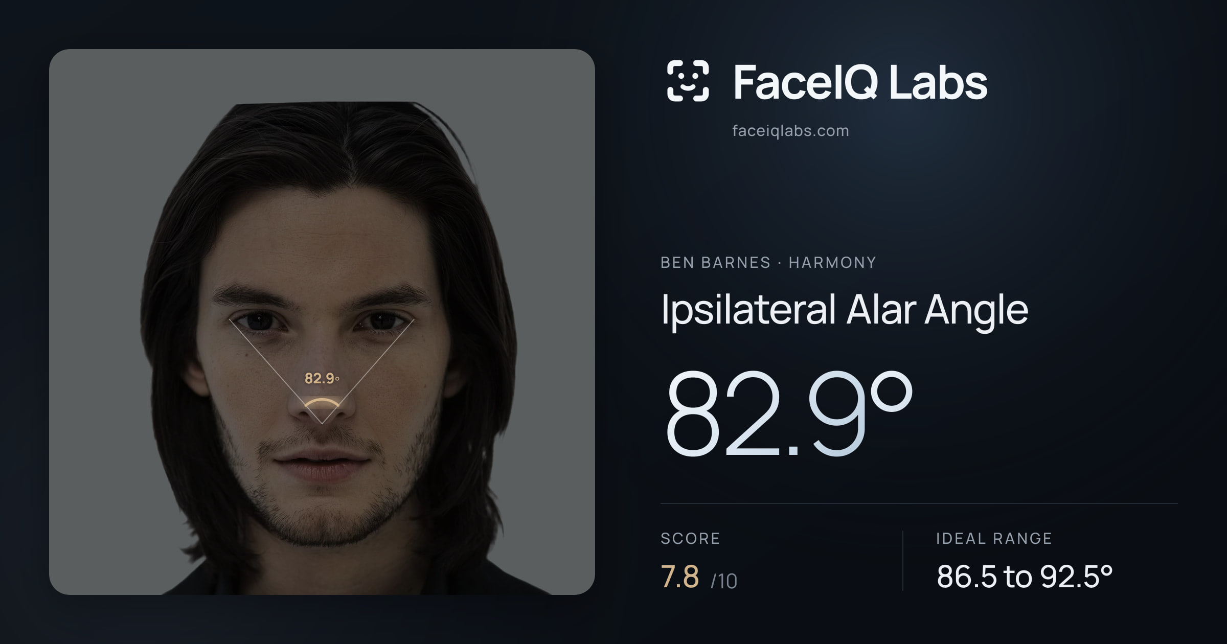 Ben Barnes Ipsilateral Alar Angle: 82.9°, drawn on the photo