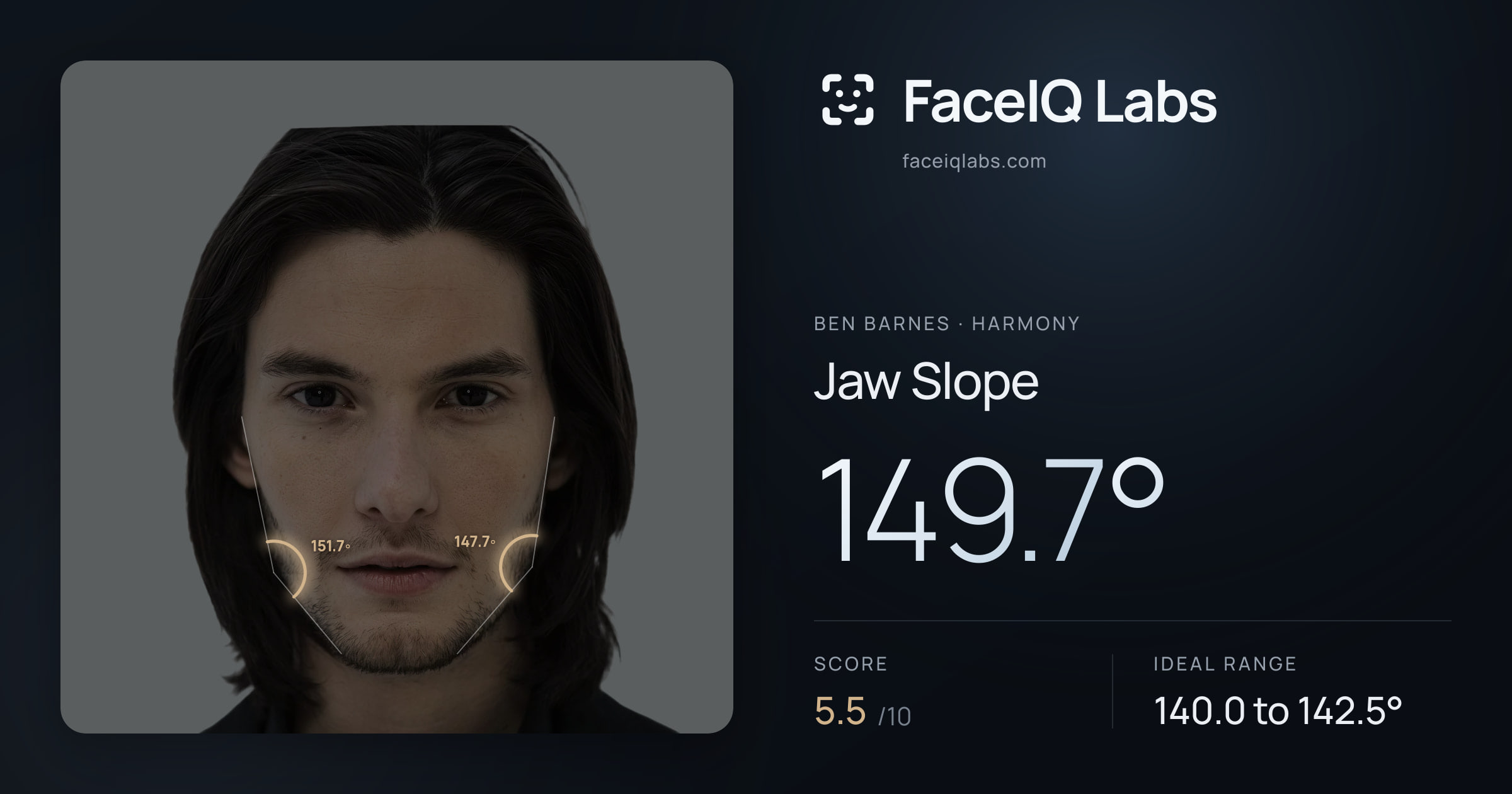 Ben Barnes Jaw Slope: 149.7°, drawn on the photo