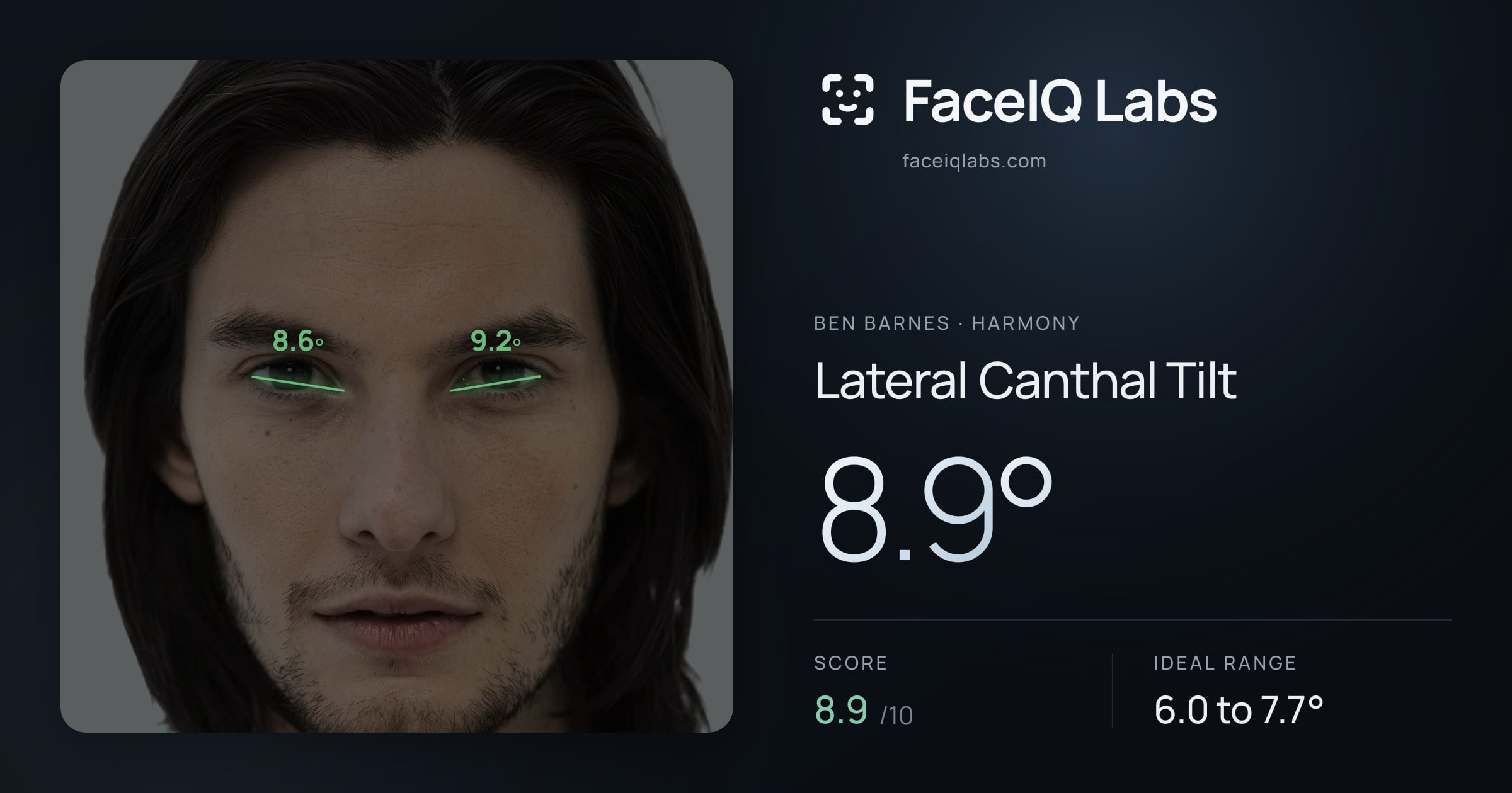 Ben Barnes Lateral Canthal Tilt: 8.9°, drawn on the photo