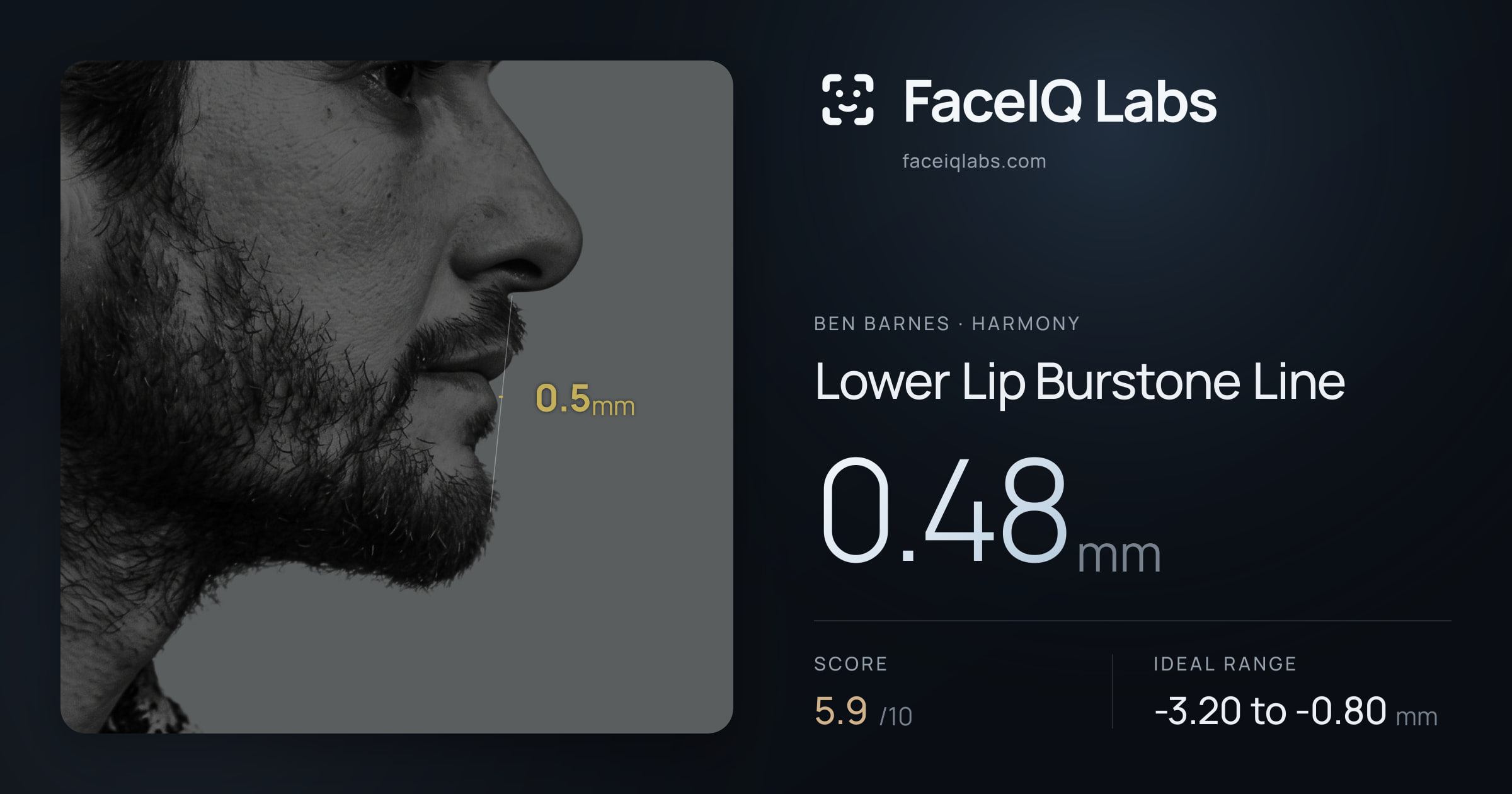 Ben Barnes Lower Lip Burstone Line: 0.48mm, drawn on the photo