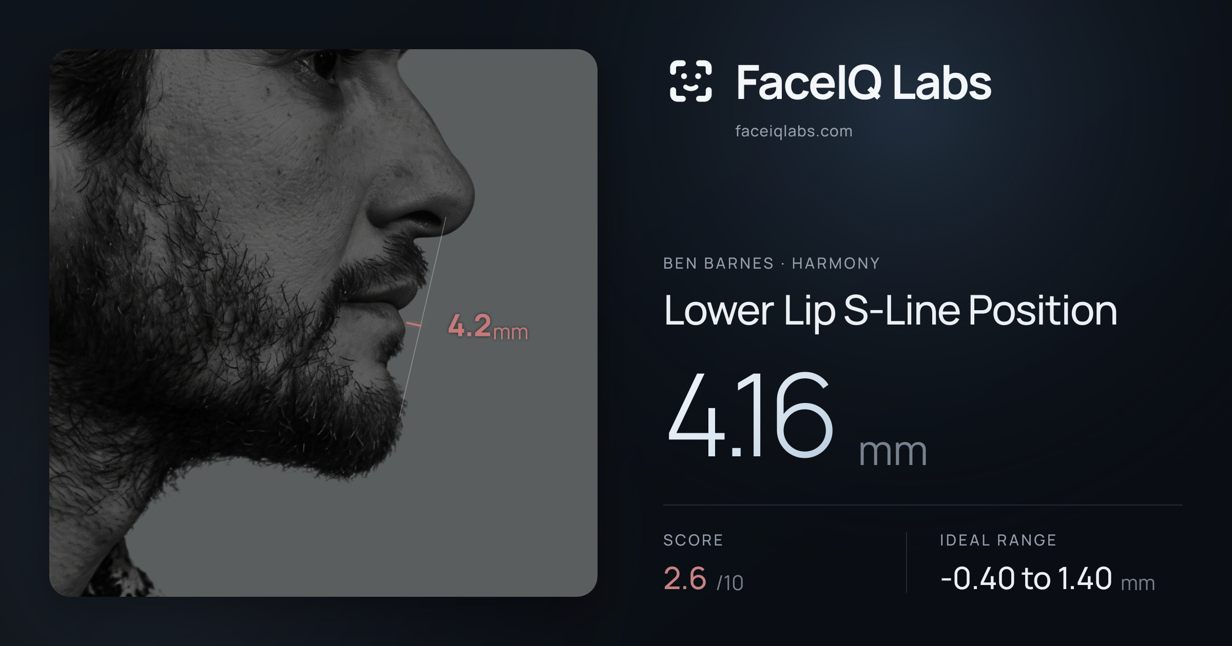 Ben Barnes Lower Lip S-Line Position: 4.16mm, drawn on the photo