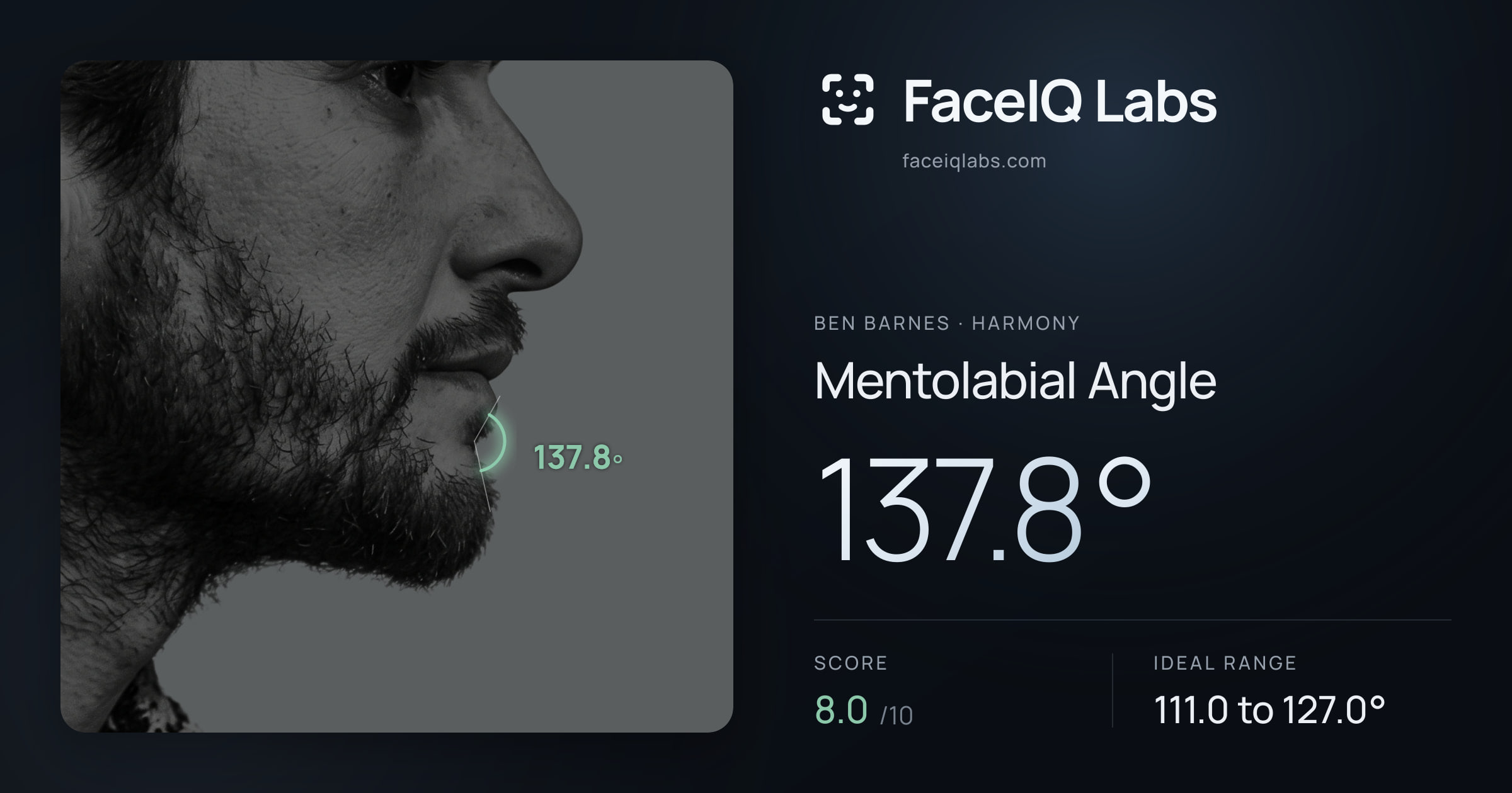 Ben Barnes Mentolabial Angle: 137.8°, drawn on the photo