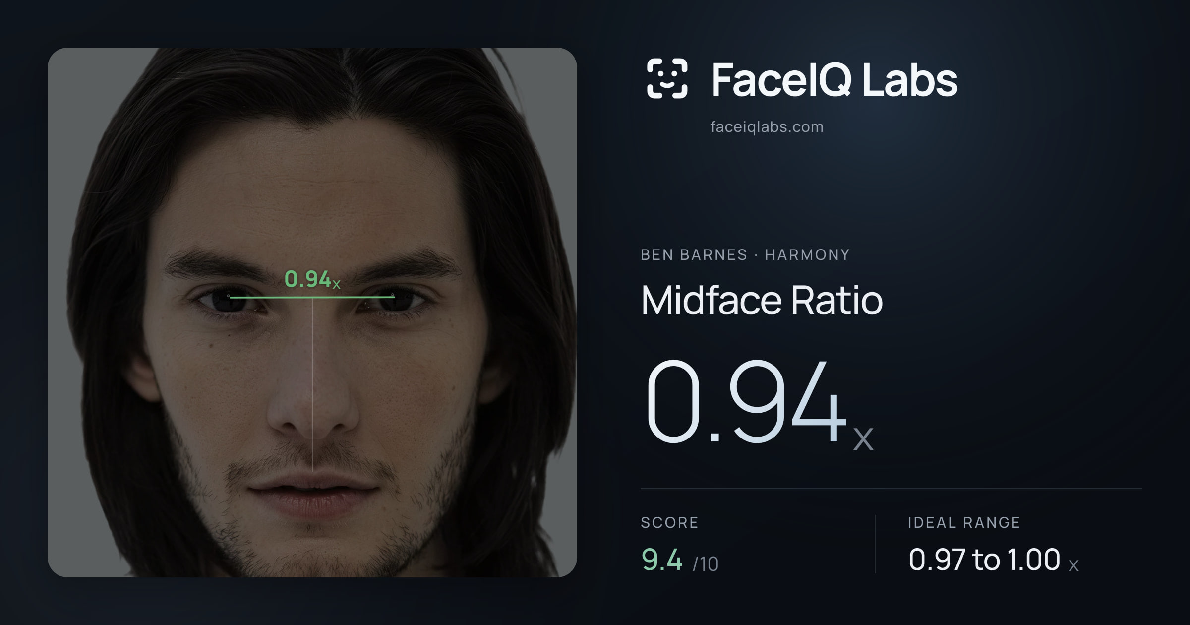 Ben Barnes Midface Ratio: 0.94x, drawn on the photo