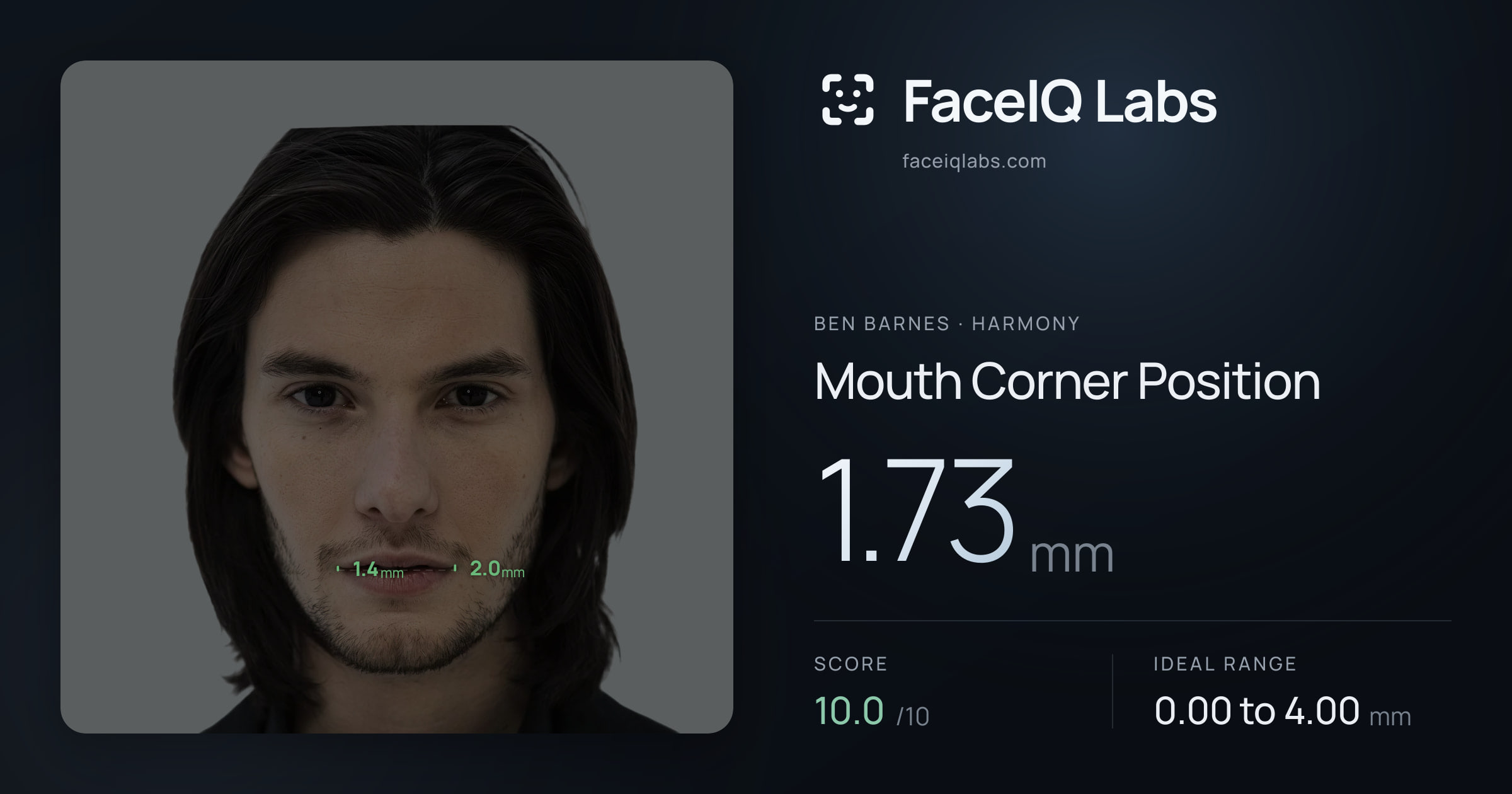 Ben Barnes Mouth Corner Position: 1.73mm, drawn on the photo