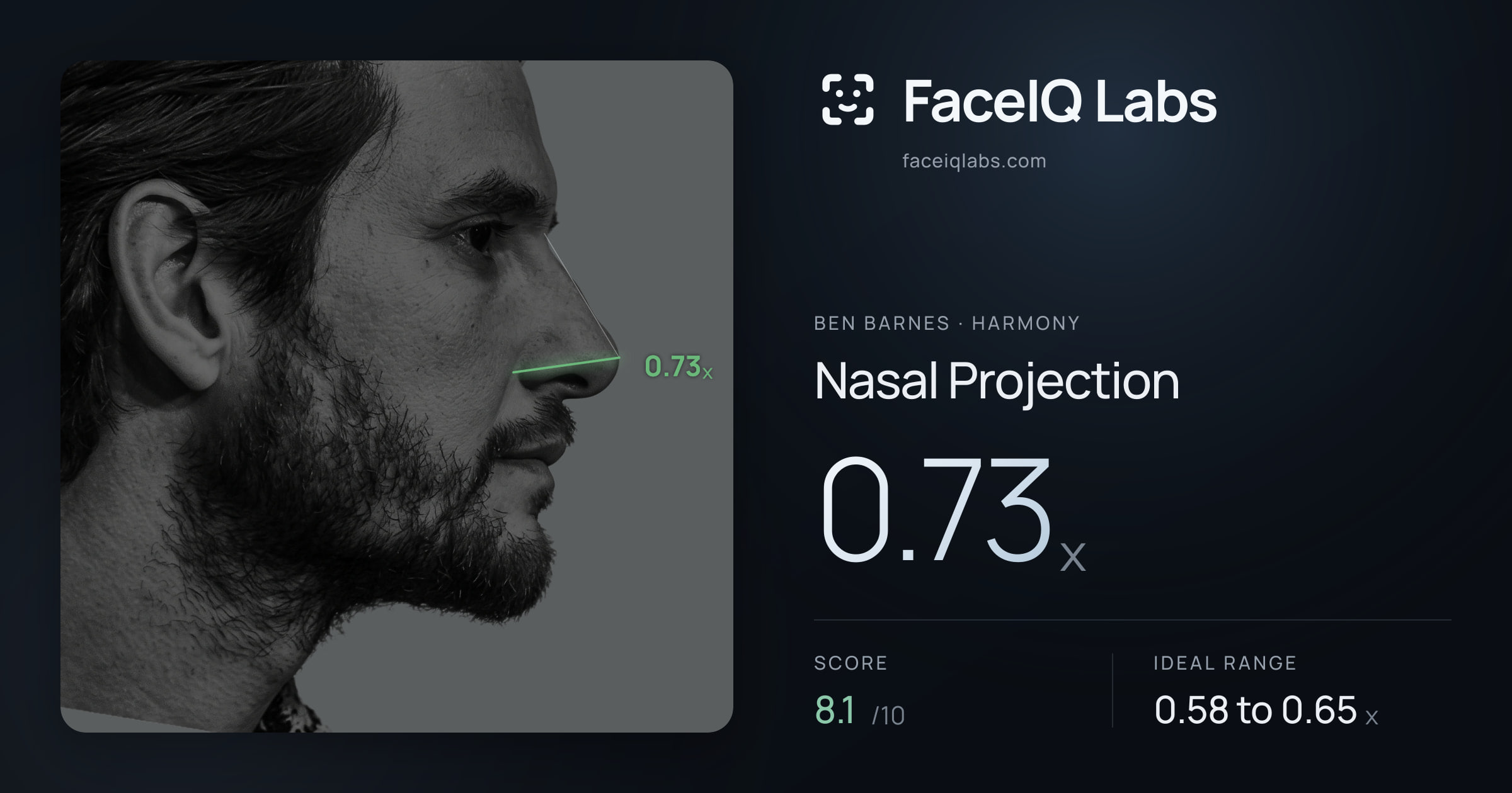 Ben Barnes Nasal Projection: 0.73x, drawn on the photo