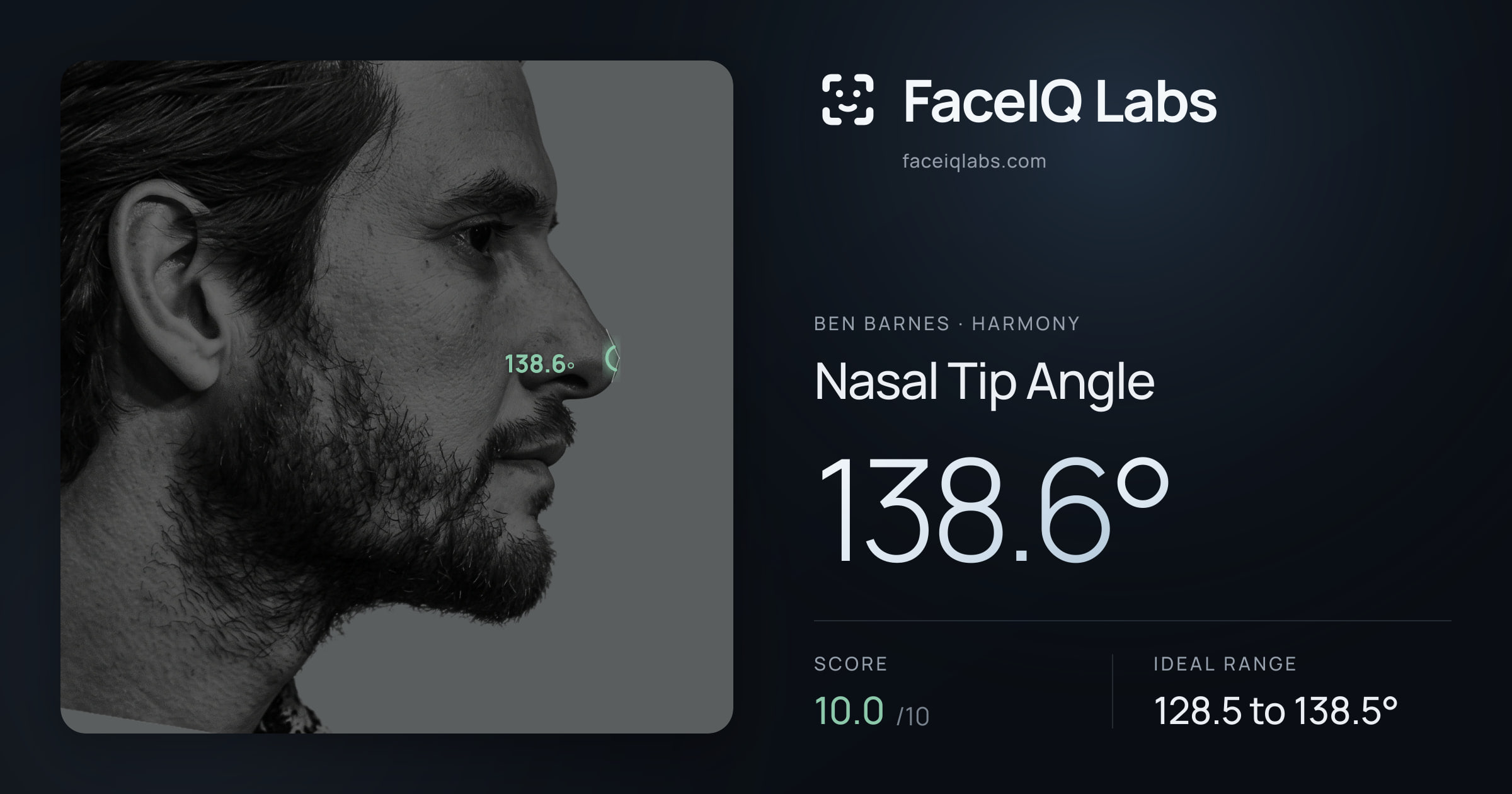 Ben Barnes Nasal Tip Angle: 138.6°, drawn on the photo