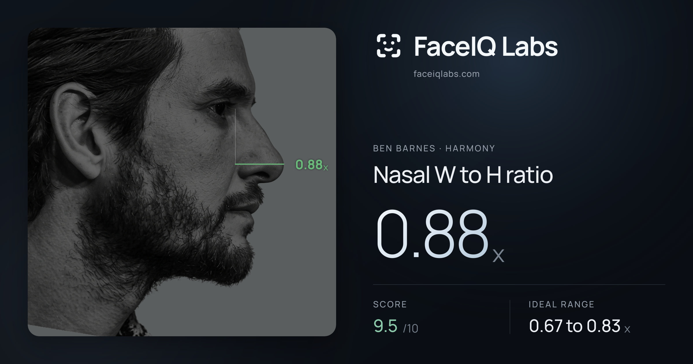 Ben Barnes Nasal W to H ratio: 0.88x, drawn on the photo